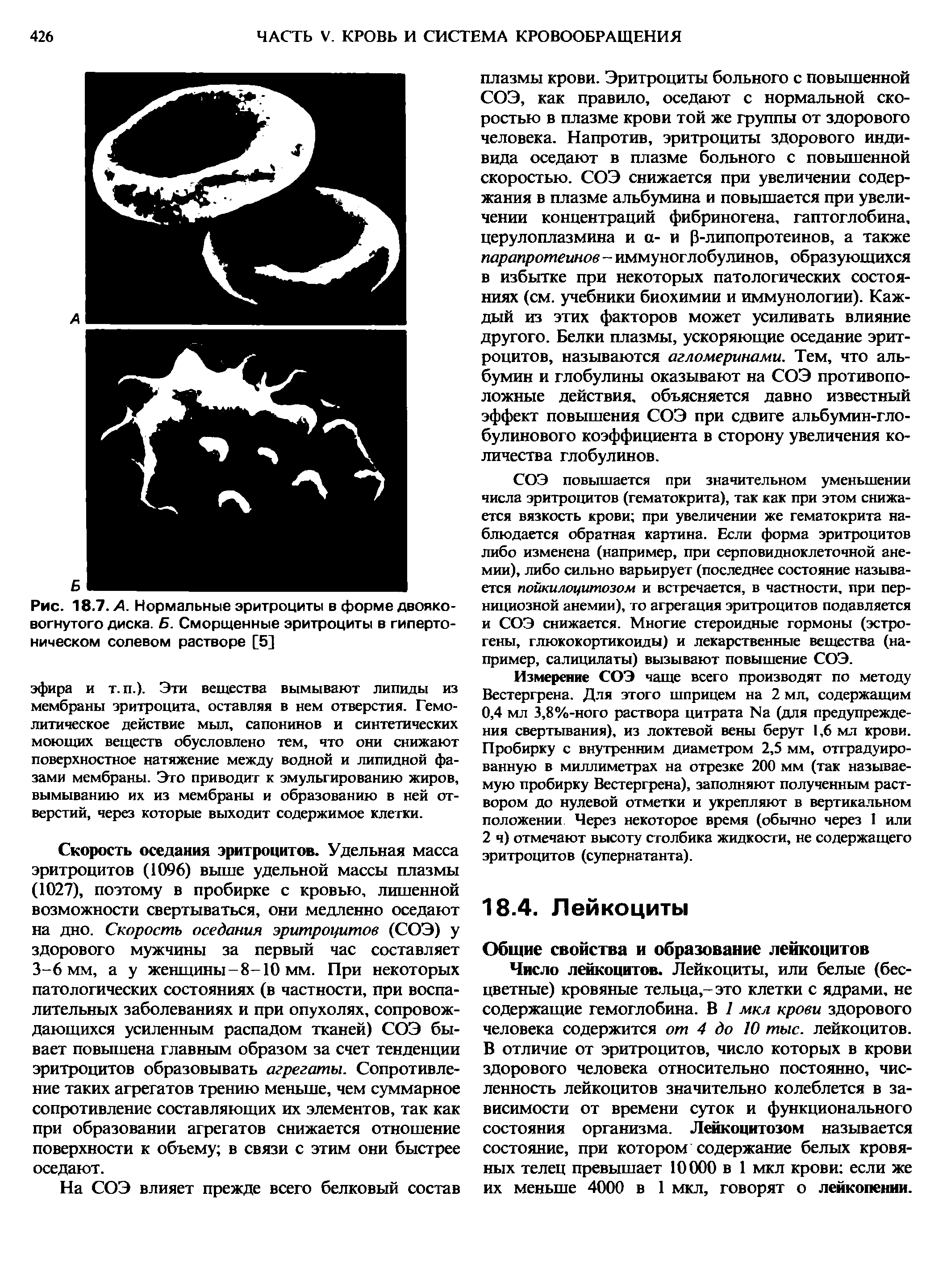 Рис. 18.7. А. Нормальные эритроциты в форме двояковогнутого диска. Б. Сморщенные эритроциты в гипертоническом солевом растворе [5]...