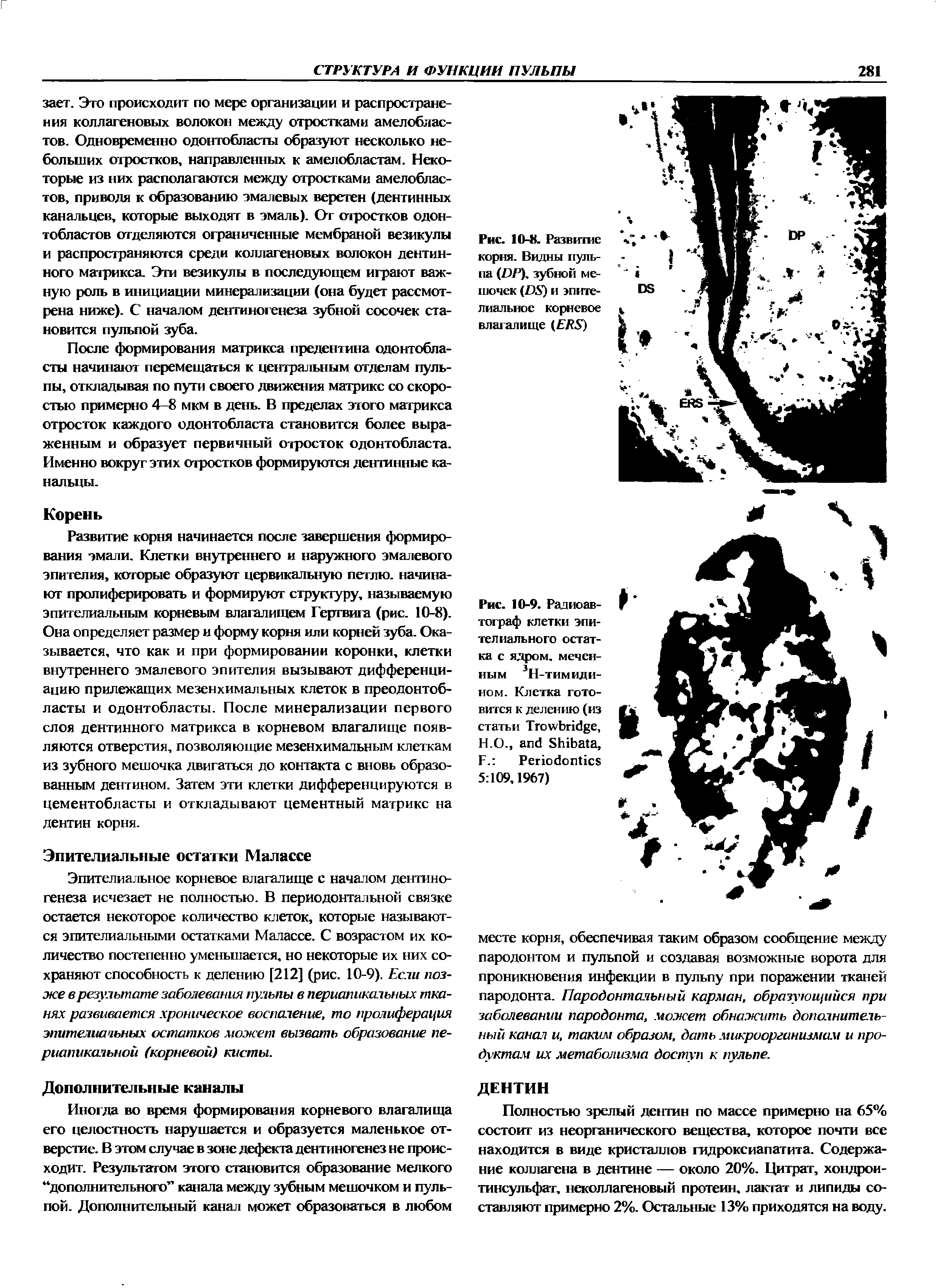 Рис. 10-8. Развитие корня. Видны пульпа (ИР), зубной мешочек (/й) и эпителиальное корневое влагалище ( 7 5)...