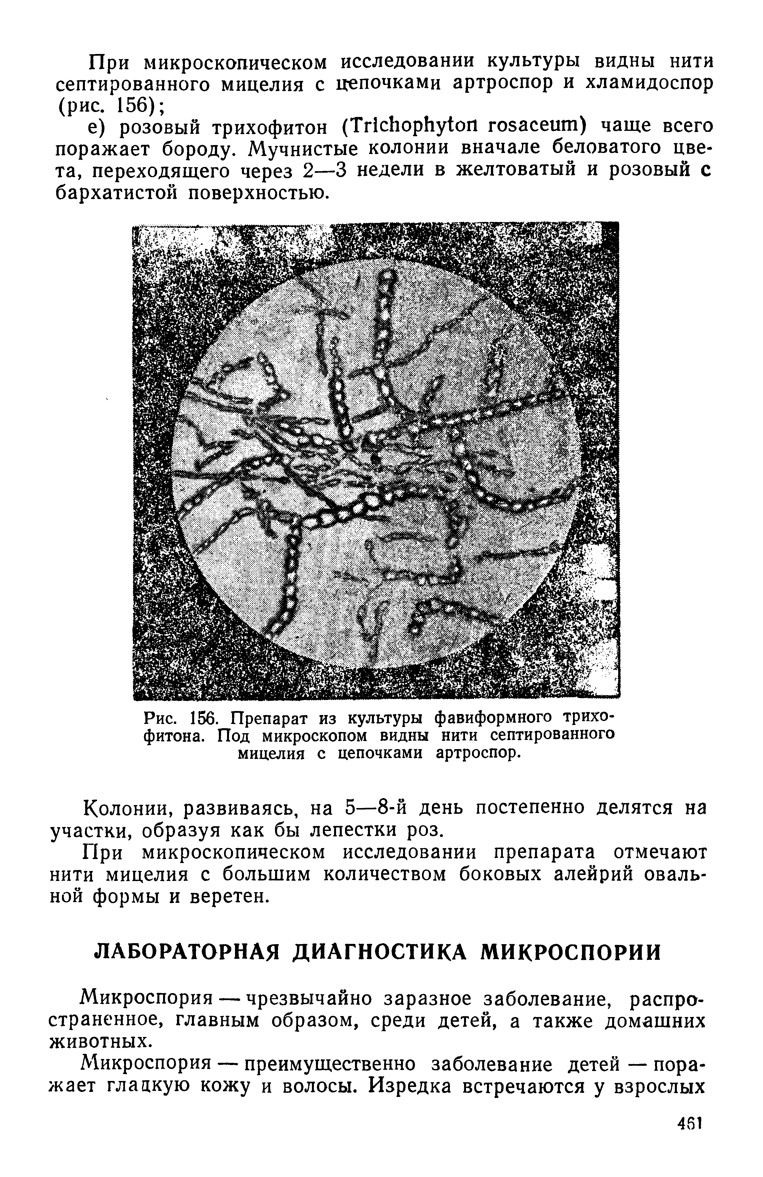 Рис. 156. Препарат из культуры фавиформного трихо-фитона. Под микроскопом видны нити септированного мицелия с цепочками артроспор.