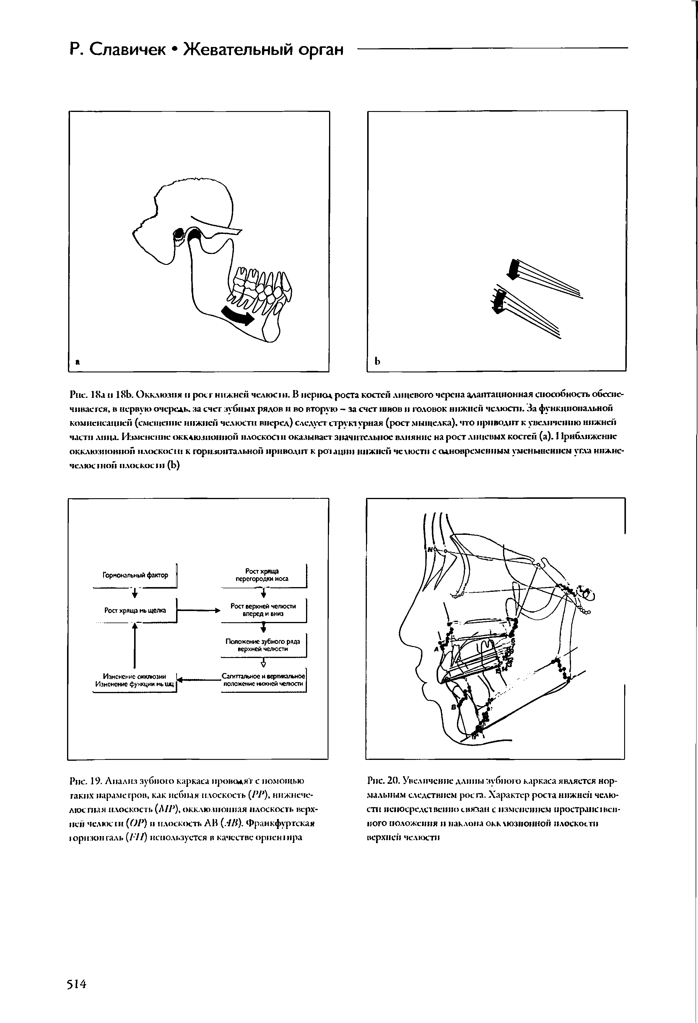 Рис. 20. Увеличение длины зубного каркаса является нормальным следствием роста. Характер роста нижней челюсти непосредственно связан с изменением пространственного положения и наклона окк чюзноиион плоскости верхней челюсти...