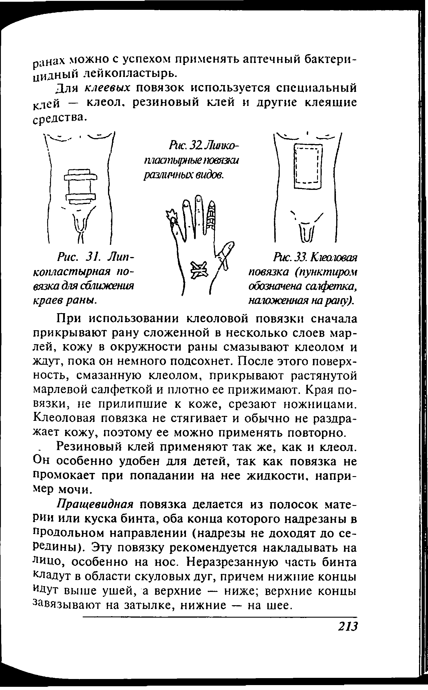 Рис. 33. Клеоловая повязка (пунктиром обозначена салфетка, наложенная на рану).