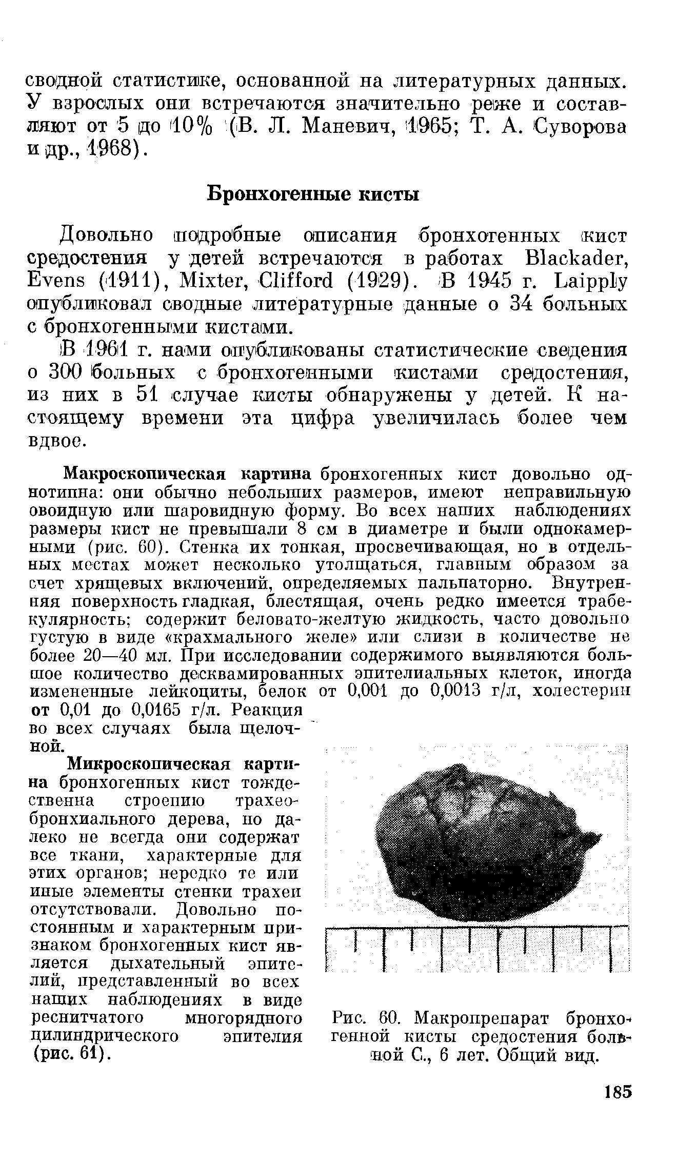 Рис. 60. Макропрепарат бронхогенной кисты средостения больной С., 6 лет. Общий вид.