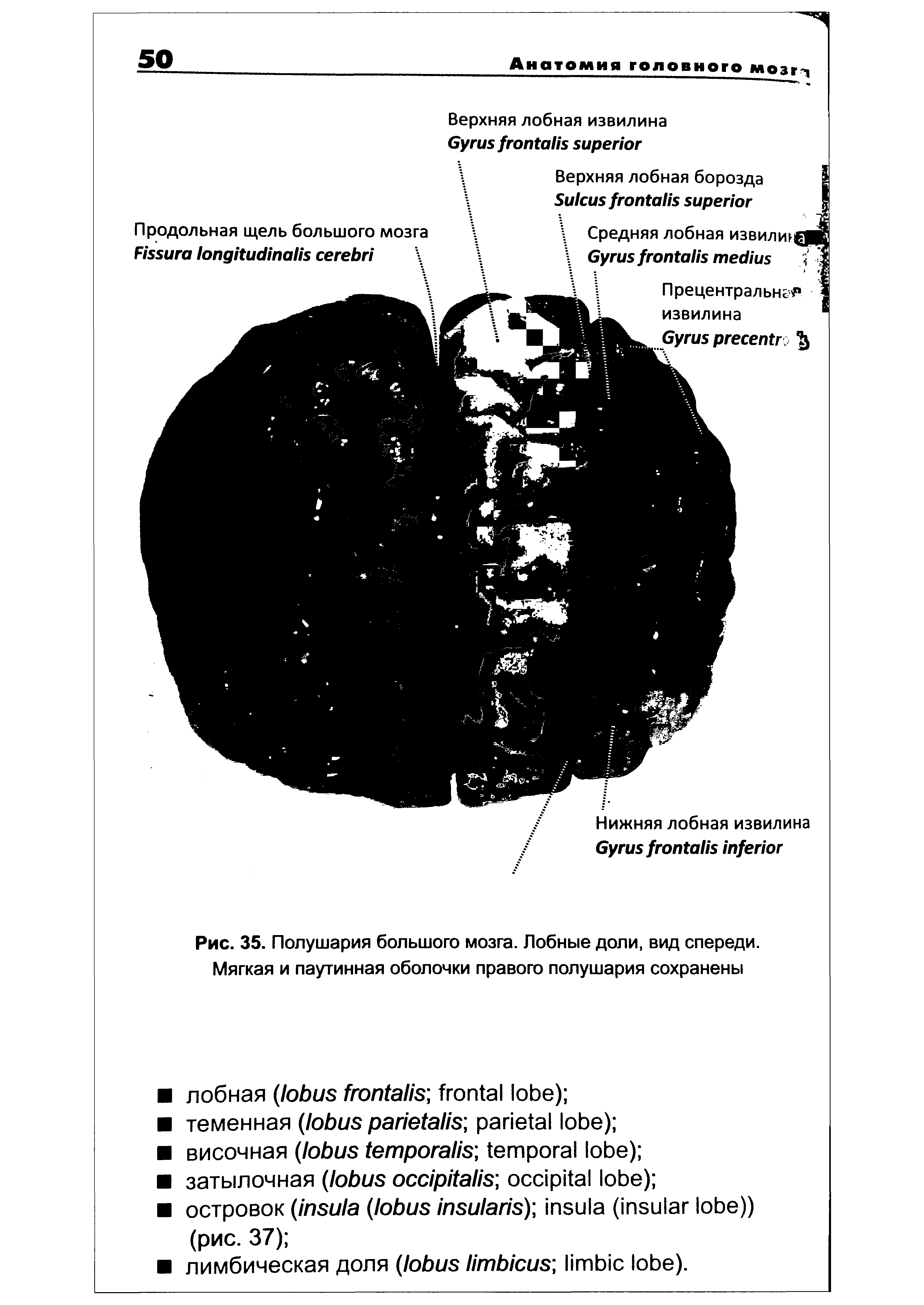 Рис. 35. Полушария большого мозга. Лобные доли, вид спереди. Мягкая и паутинная оболочки правого полушария сохранены...