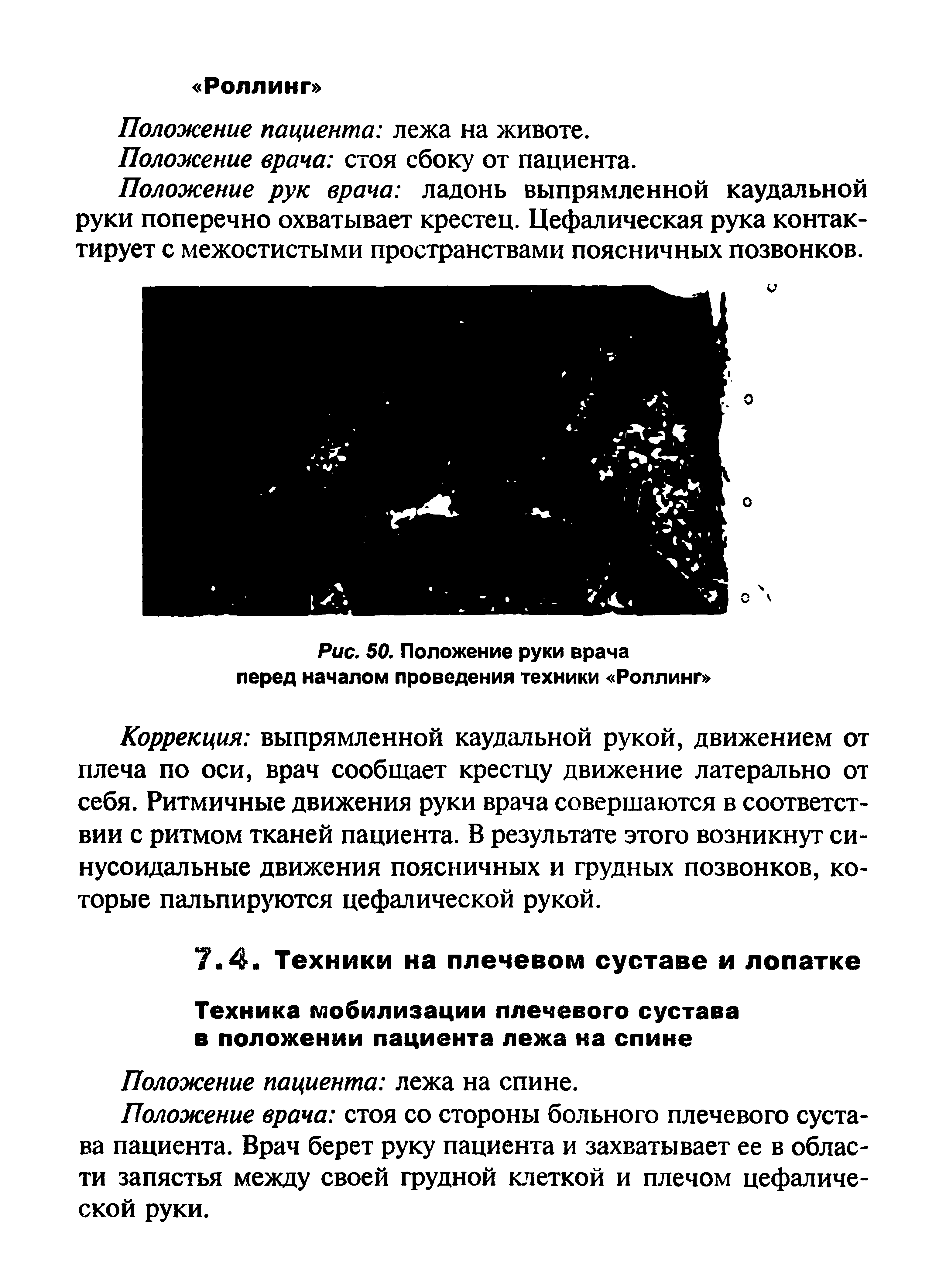 Рис. 50. Положение руки врача перед началом проведения техники Роллинг ...