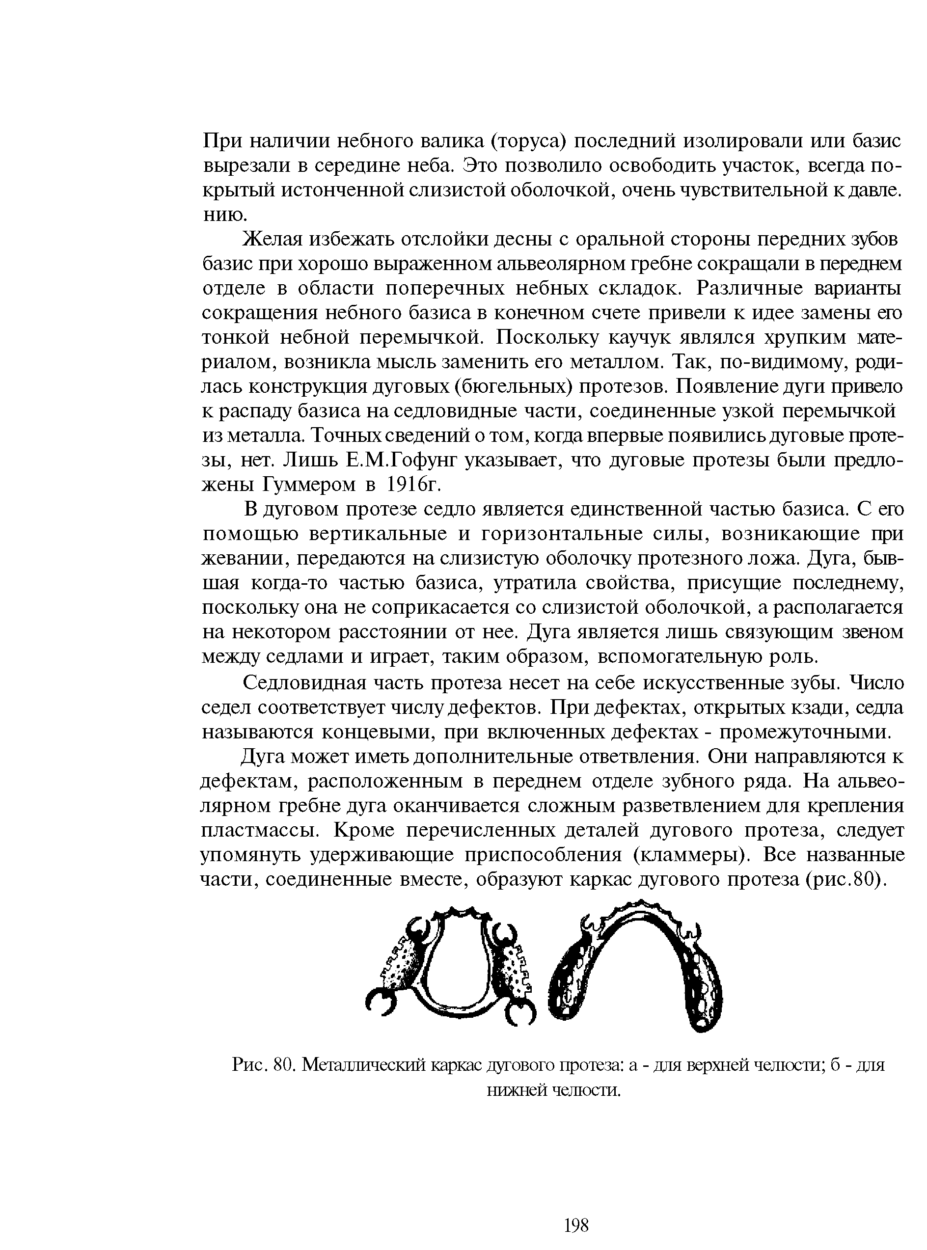 Рис. 80. Металлический каркас дугового протеза а - для верхней челюсти б - для нижней челюсти.