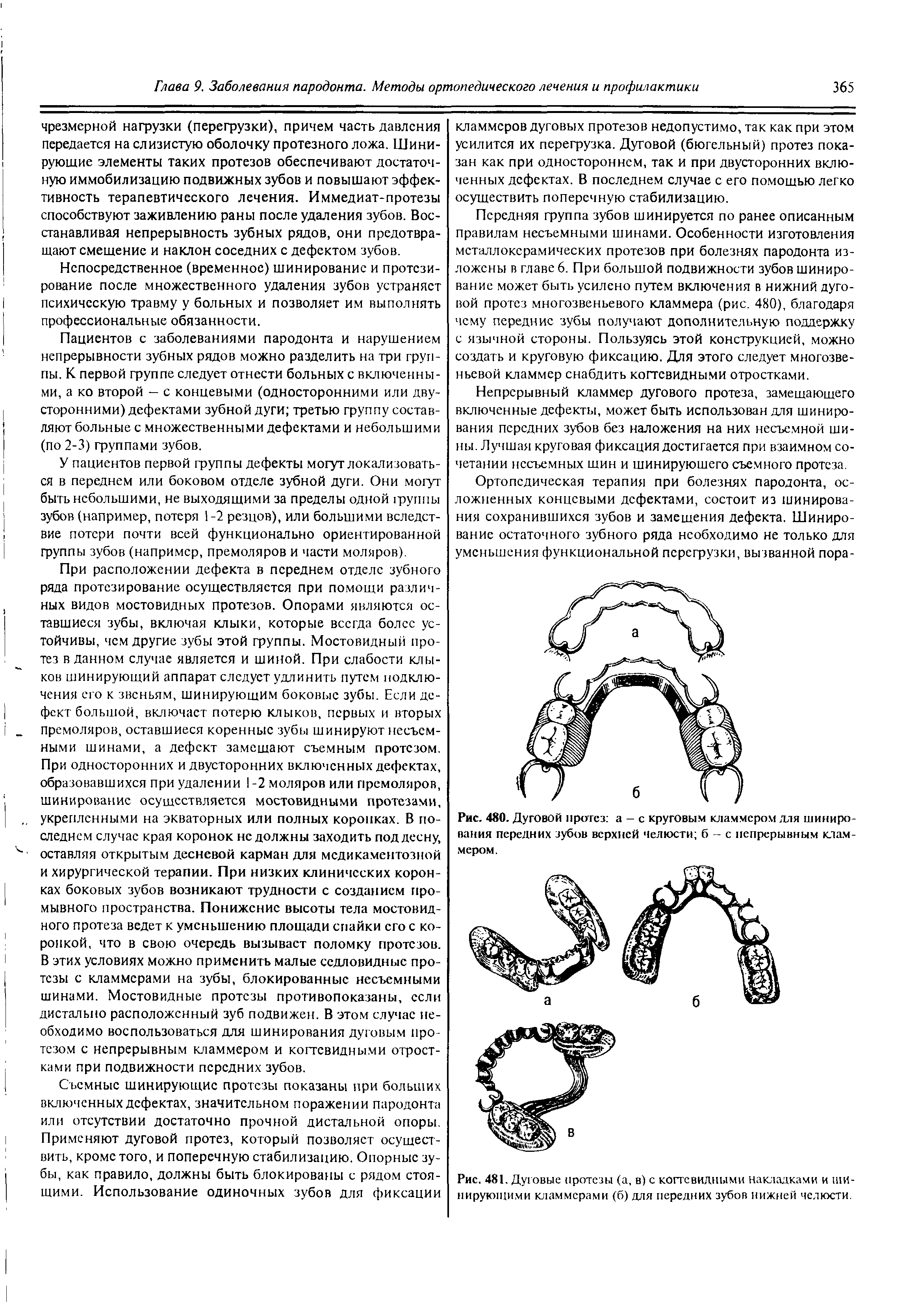 Рис. 480. Дуговой протез а - с круговым кламмером для шинирования передних зубов верхней челюсти б - с непрерывным Кламмером.