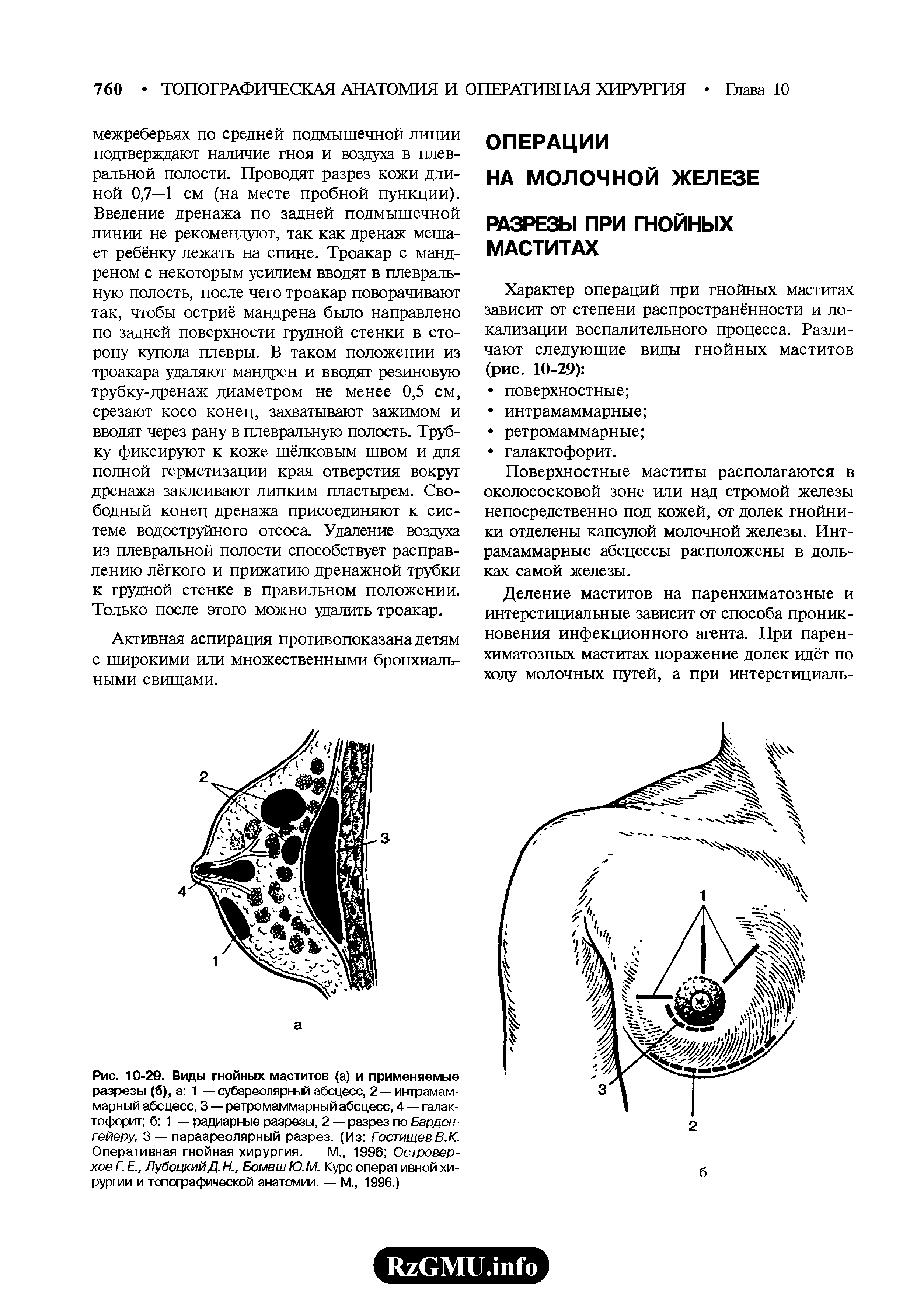 Рис. 10-29. Виды гнойных маститов (а) и применяемые разрезы (б), а 1 — субареолярный абсцесс, 2 —интрамам-марный абсцесс, 3 — ретромаммарный абсцесс, 4 — галактофорит б 1 — радиарные разрезы, 2 — разрез по Барден-гейеру, 3— параареолярный разрез. (Из ГостищевВ.К. Оперативная гнойная хирургия. — М., 1996 Островерхое Г. Е., ЛубоцкийД. Н., Бомаш Ю.М. Курс оперативной хирургии и топографической анатомии. — М., 1996.)...