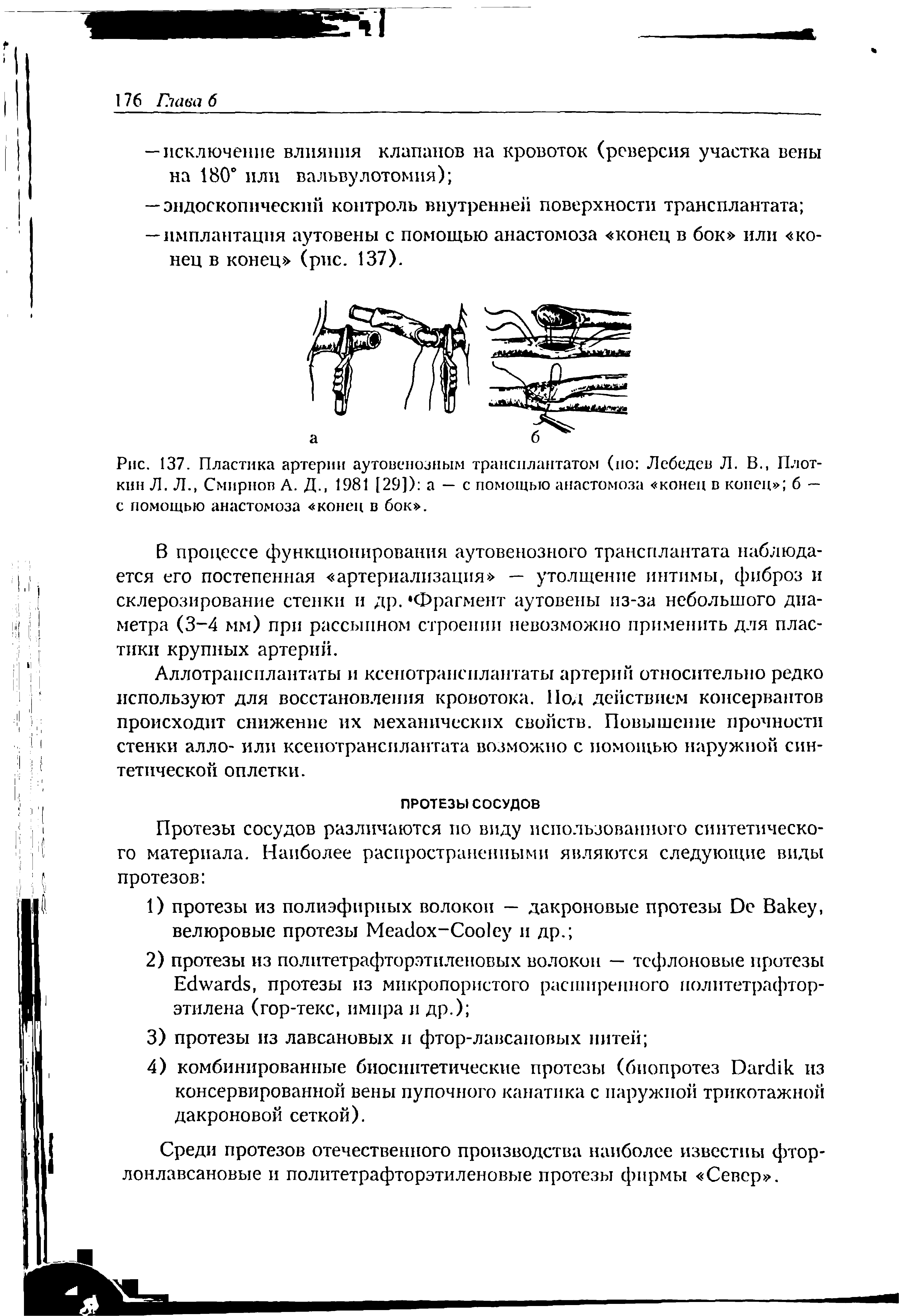 Рис. 137. Пластика артерия аутовенозным трансплантатом (по Лебедев Л. В., Плоткин Л. Л., Смирнов А. Д., 1981 [29]) а — с помощью анастомоза конец в конец б — с помощью анастомоза конец в бок .