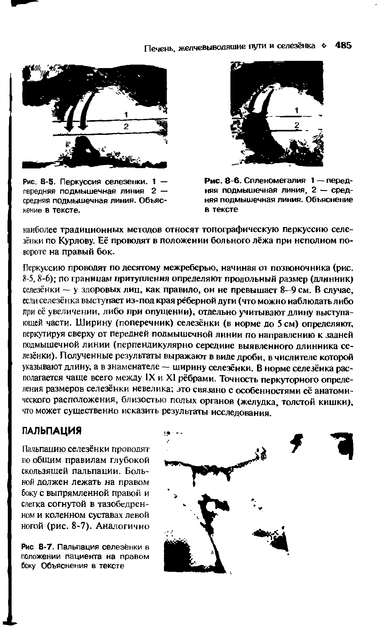 Рис. 8-5. Перкуссия селезенки. 1 — передняя подмышечная линия 2 — средняя подмышечная линия. Объяснение в тексте.