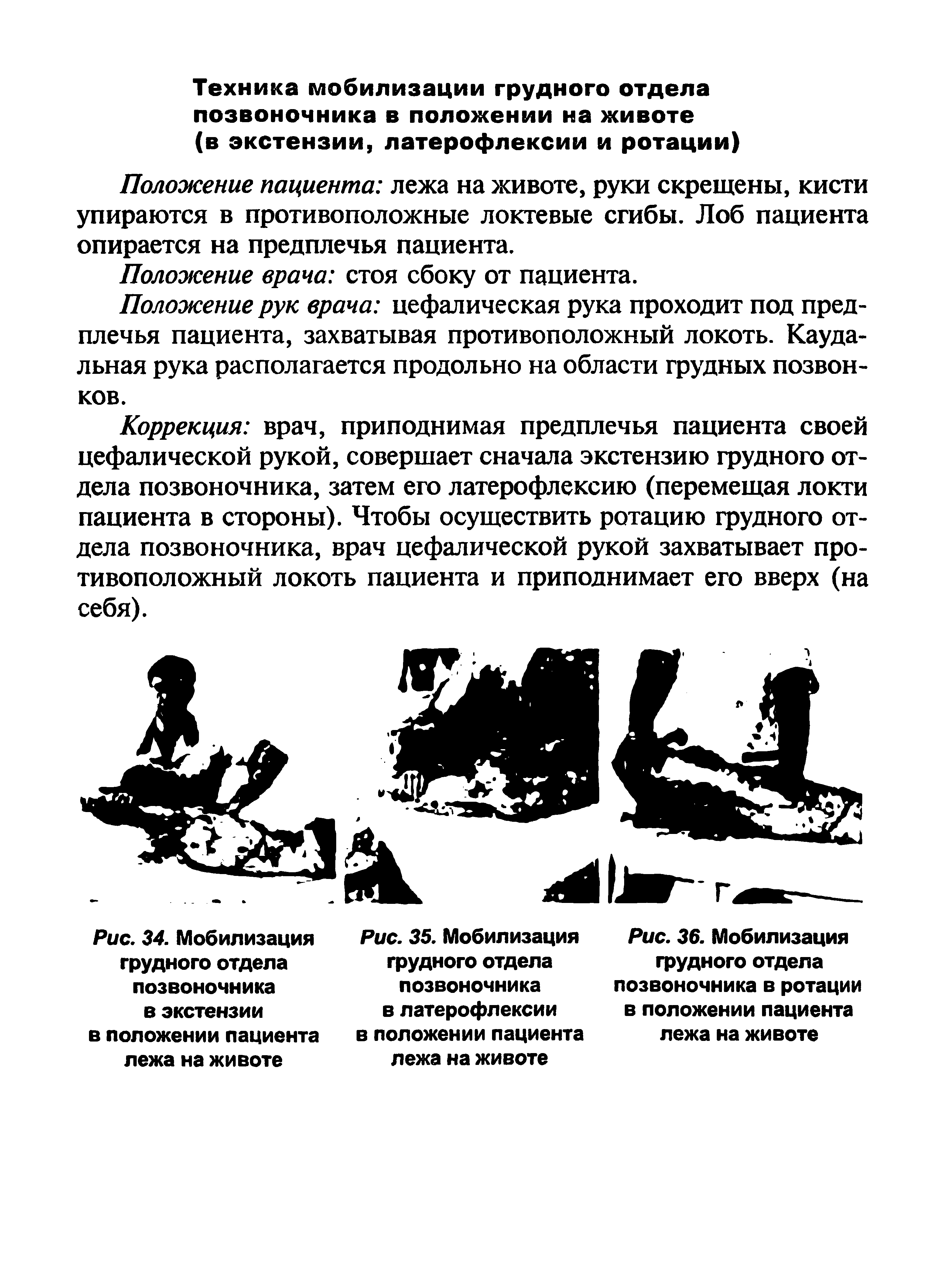 Рис. 36. Мобилизация грудного отдела позвоночника в ротации в положении пациента лежа на животе...