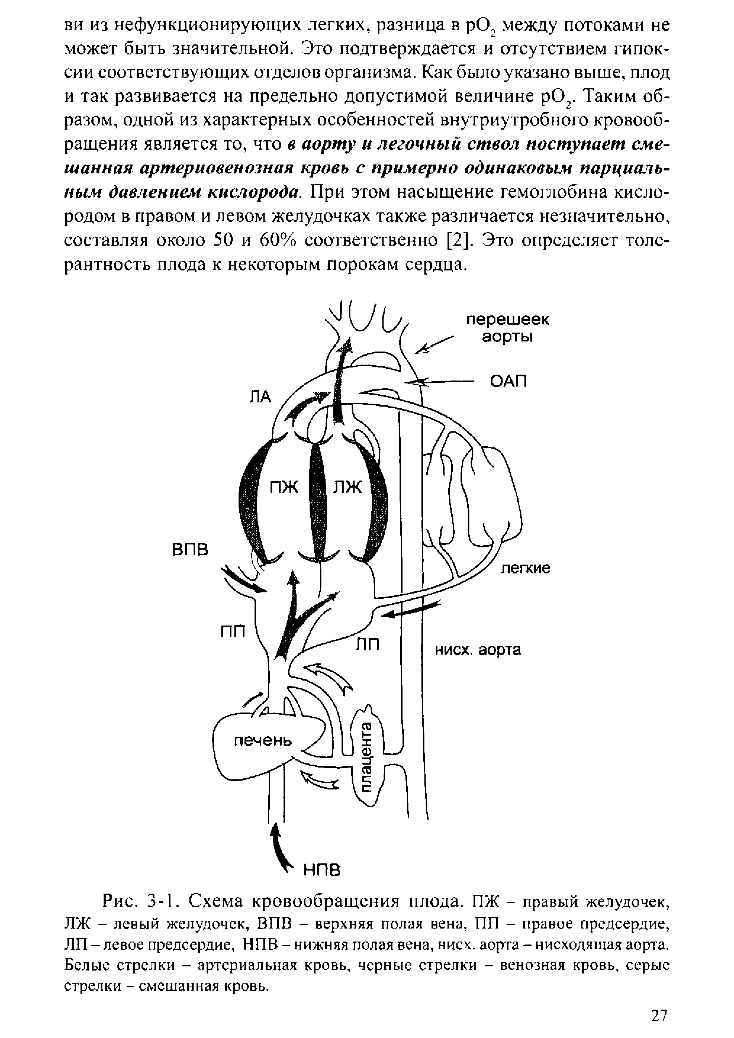 Рис. 3-1. Схема кровообращения плода. ПЖ - правый желудочек, ЛЖ - левый желудочек, ВПВ - верхняя полая вена, ПП - правое предсердие, ЛП - левое предсердие, НПВ - нижняя полая вена, нисх. аорта - нисходящая аорга. Белые стрелки - артериальная кровь, черные стрелки - венозная кровь, серые стрелки - смешанная кровь.