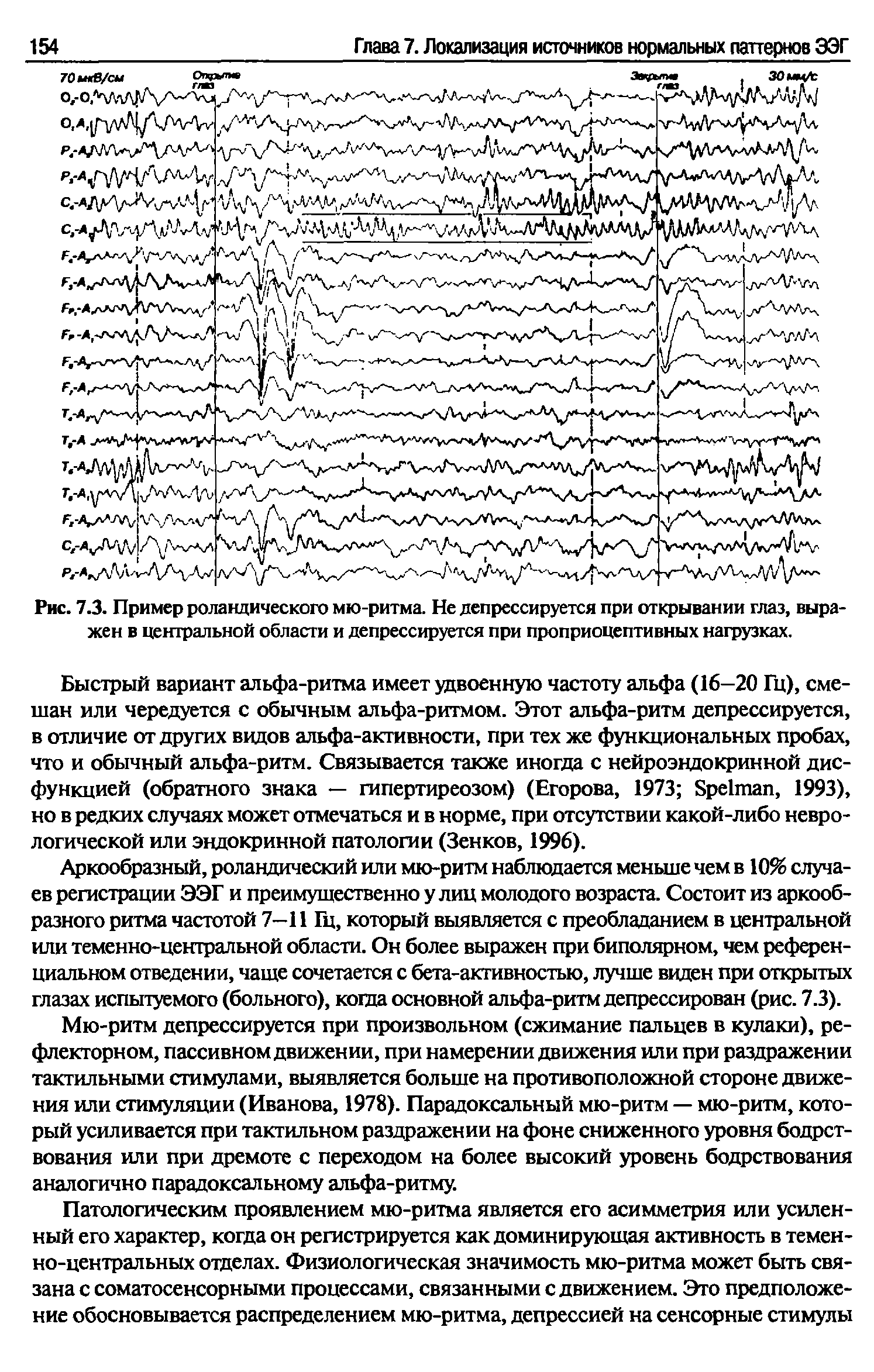 Рис. 7.3. Пример роландического мю-ритма. Не депрессируется при открывании глаз, выражен в центральной области и депрессируется при проприоцептивных нагрузках.