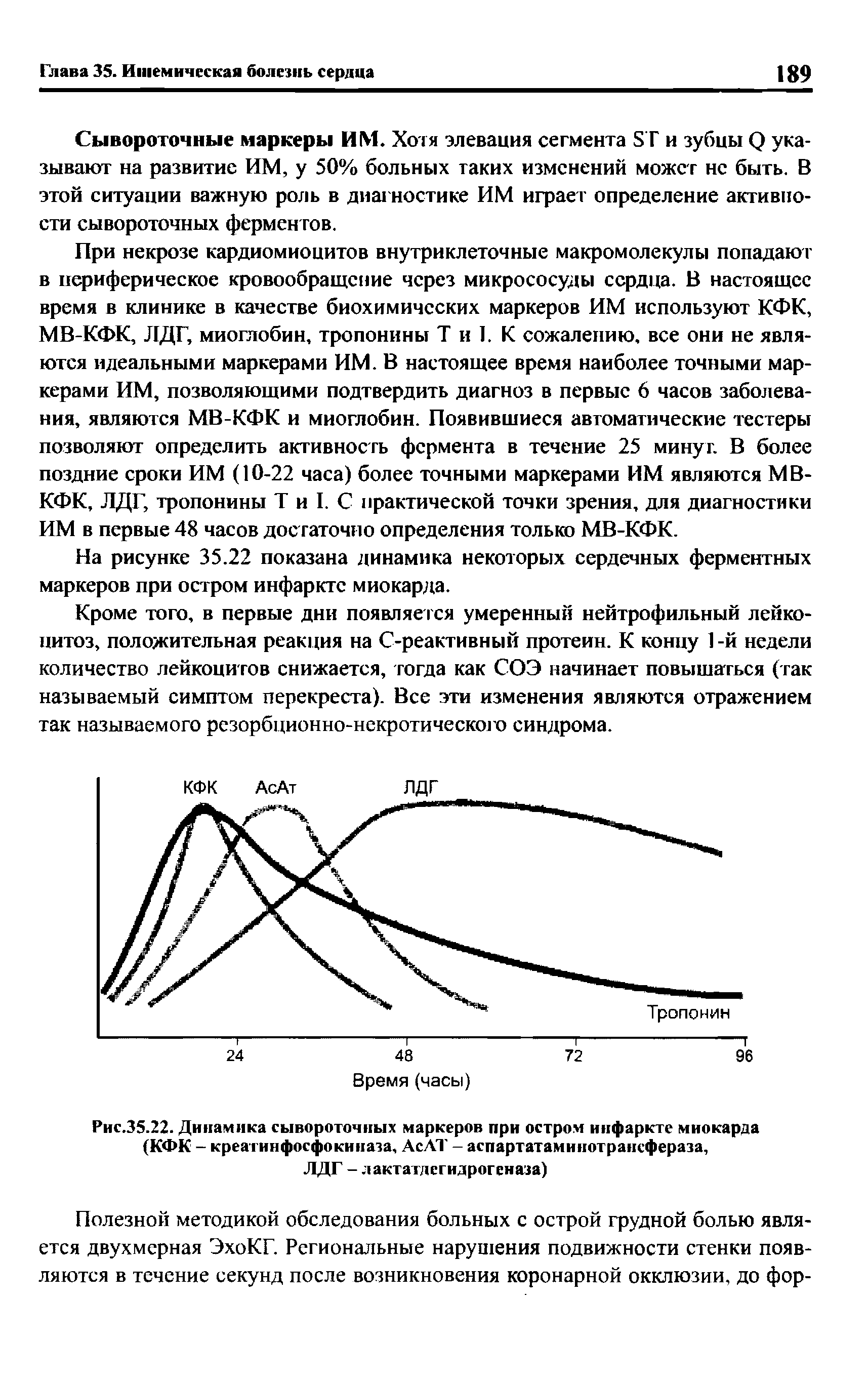 Рис.35.22. Динамика сывороточных маркеров при остром инфаркте миокарда (КФК - креатинфосфокиназа, АсАТ - аспартатаминотрансфераза, ЛДГ -лактатдегидрогеназа)...