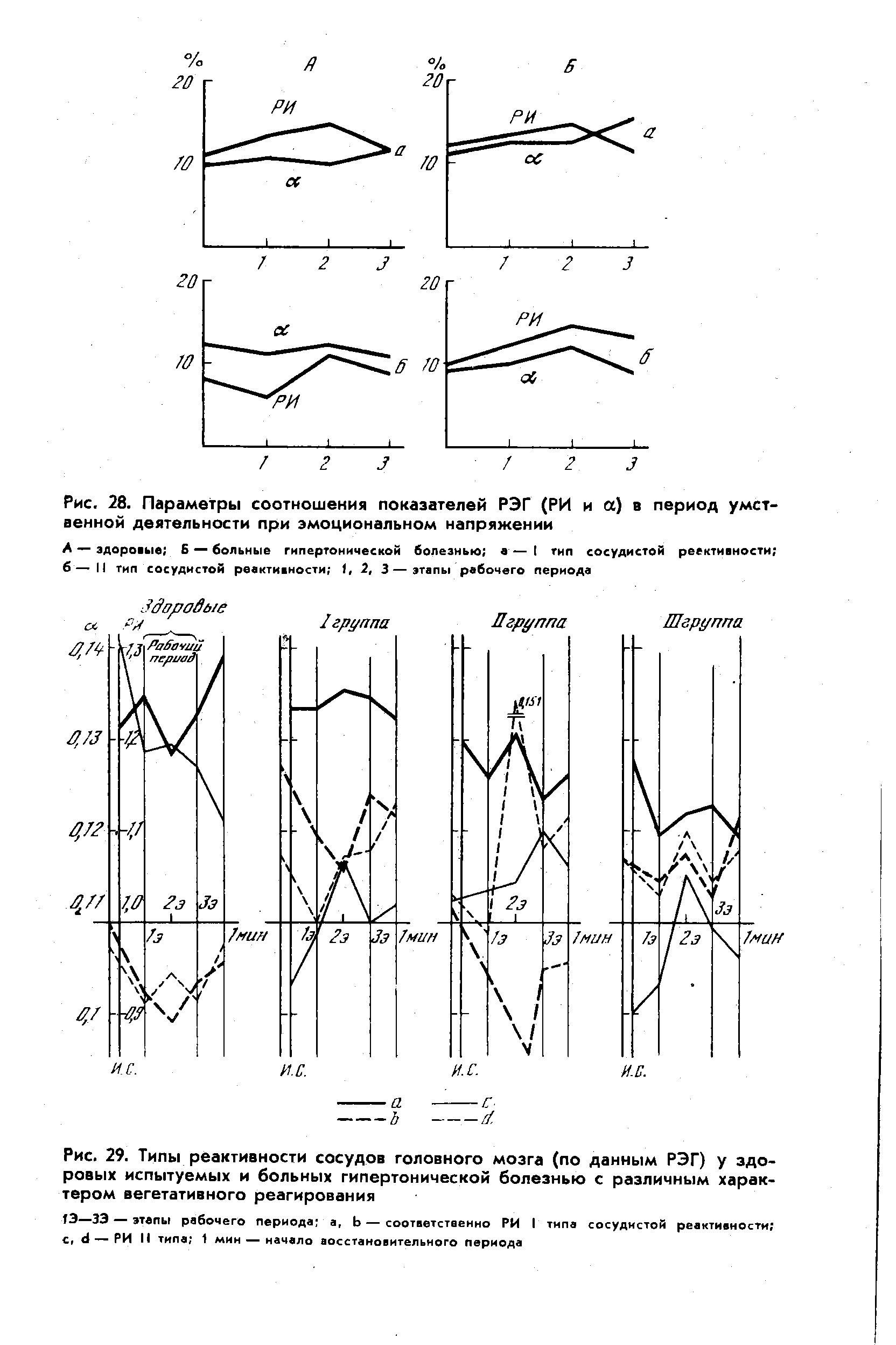 Рис. 29. Типы реактивности сосудов головного мозга (по данным РЭГ) у здоровых испытуемых и больных гипертонической болезнью с различным характером вегетативного реагирования...