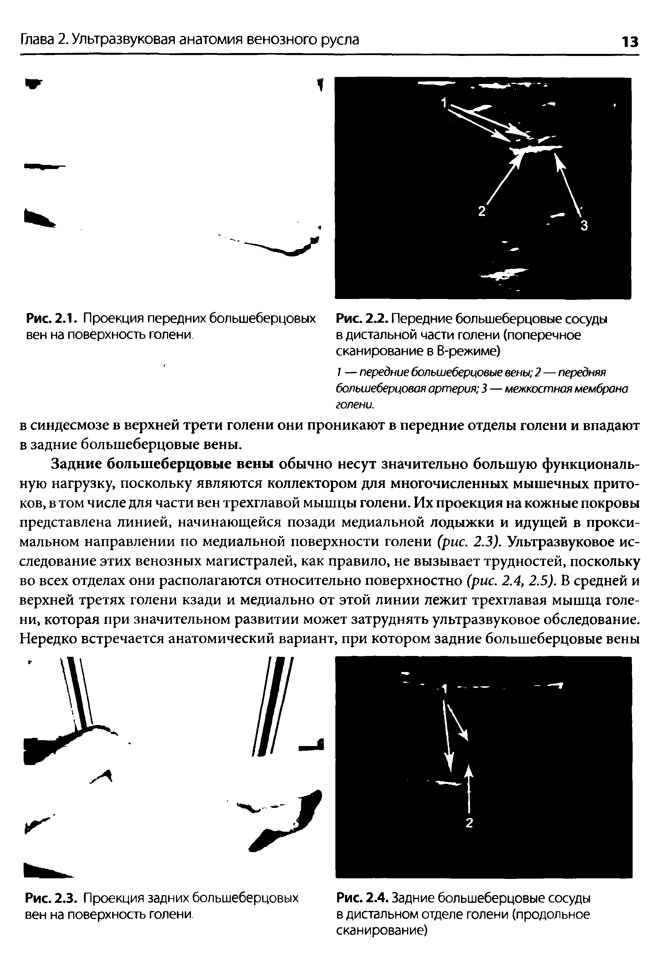 Рис. 2.2. Передние большеберцовые сосуды в дистальной части голени (поперечное сканирование в В-режиме)...