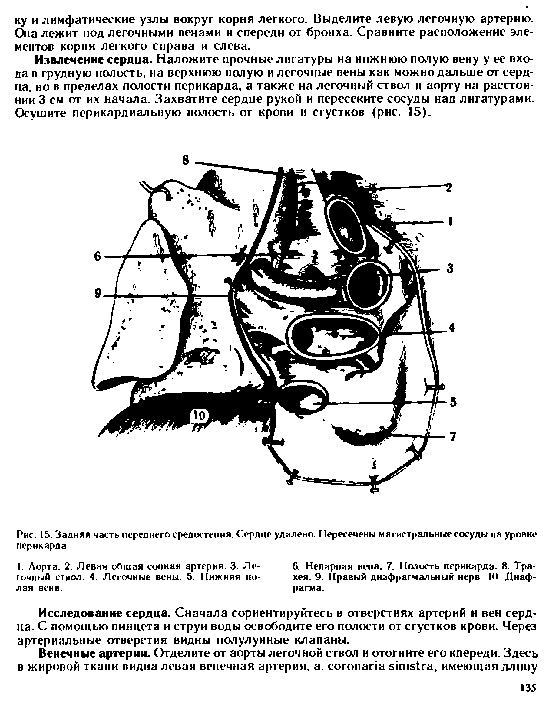 Рис. 15. Задняя часть переднего средостения. Сердце удалено. Пересечены магистральные сосуды на уровне перикарда...