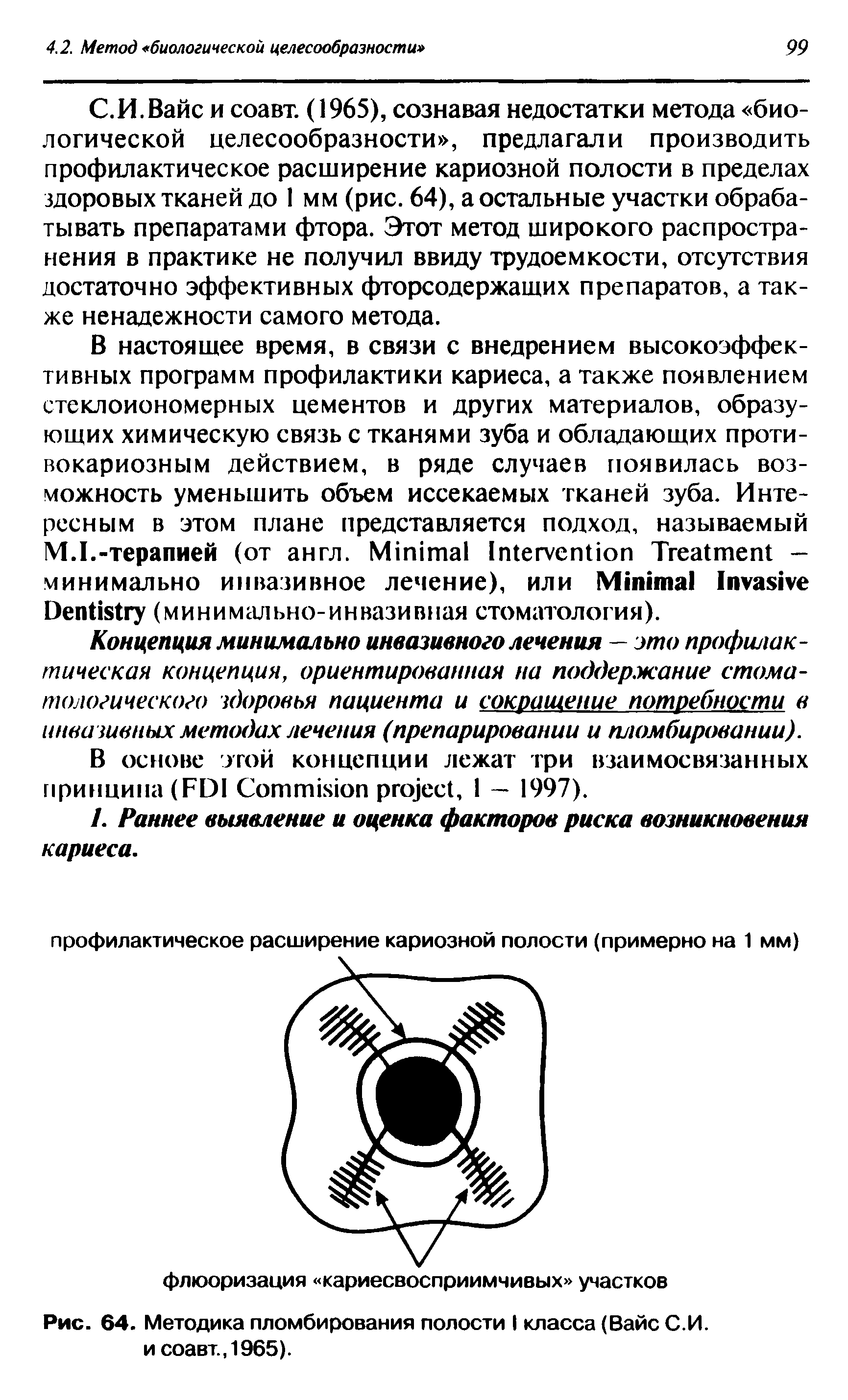 Рис. 64. Методика пломбирования полости I класса (Вайс С.И. и соавт., 1965).