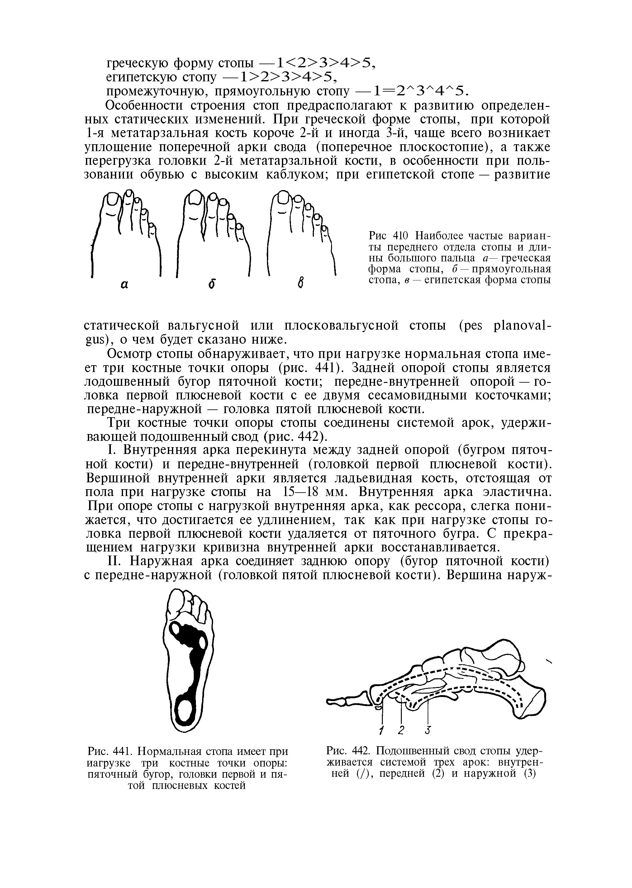 Рис. 441. Нормальная стопа имеет при нагрузке три костные точки опоры пяточный бугор, головки первой и пятой плюсневых костей...