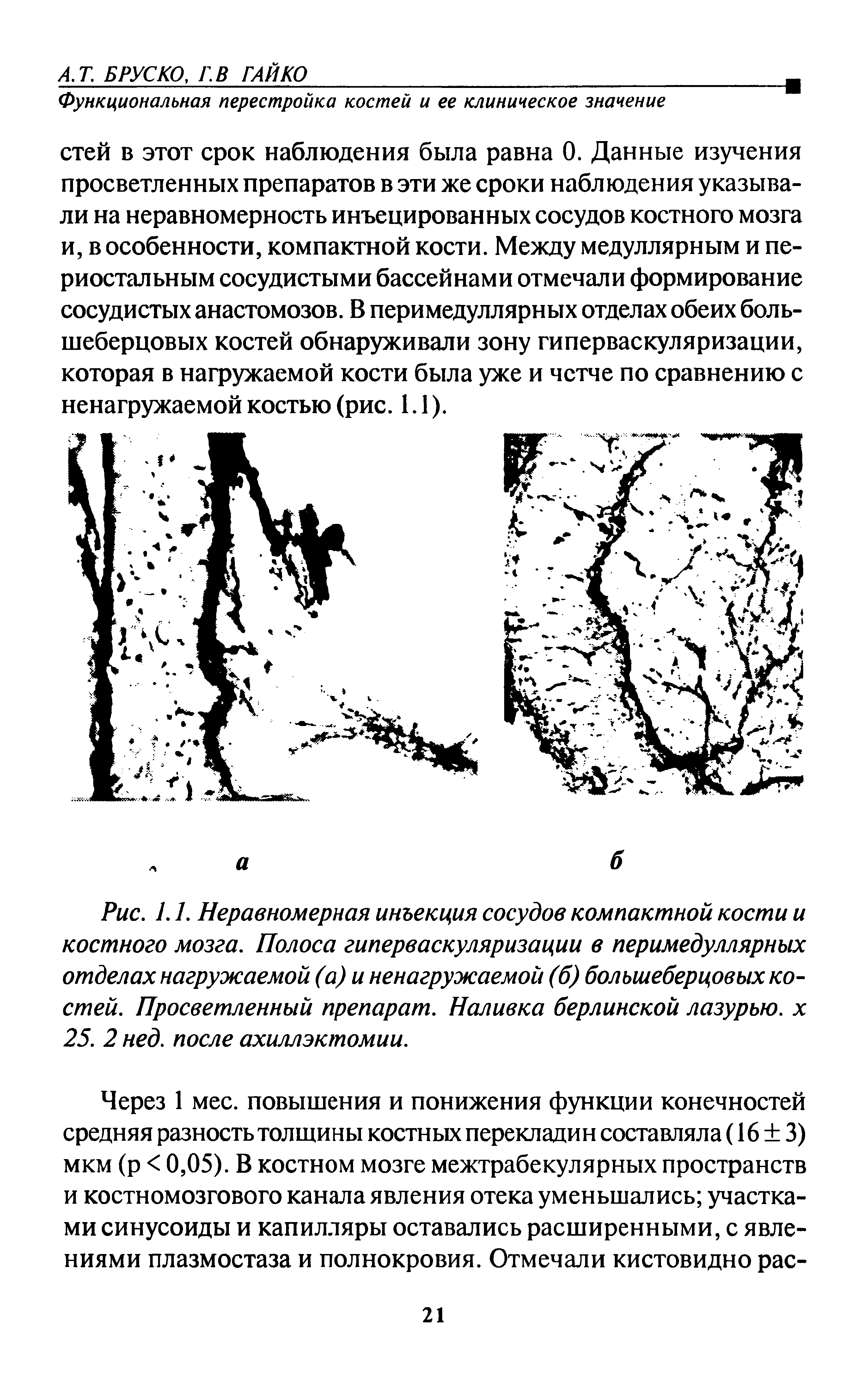 Рис. 1.1. Неравномерная инъекция сосудов компактной кости и костного мозга. Полоса гиперваскуляризации в перимедуллярных отделах нагружаемой (а) и ненагружаемой (б) большеберцовых костей. Просветленный препарат. Наливка берлинской лазурью, х 25. 2 нед. после ахиллэктомии.