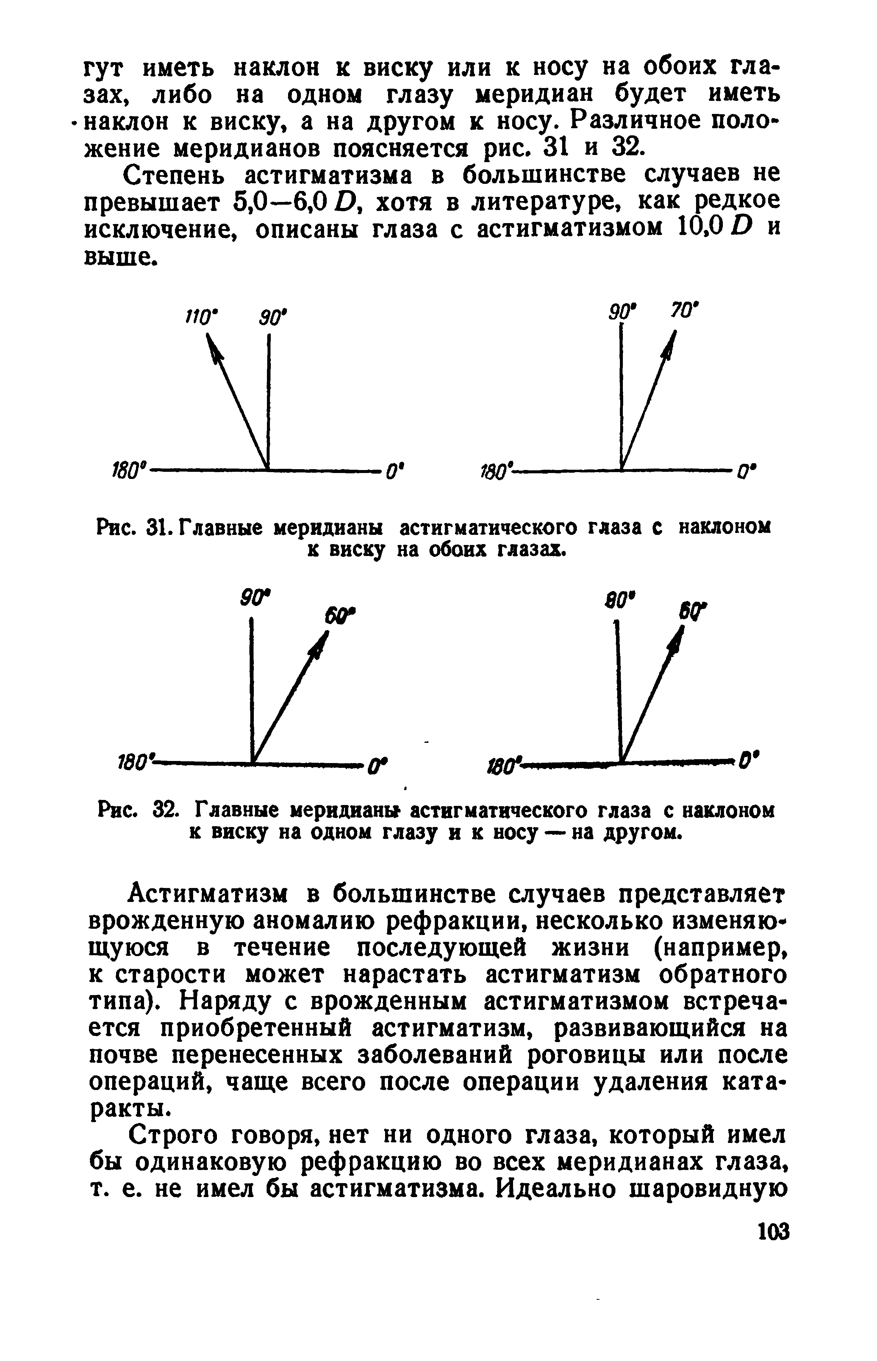 Рис. 31. Главные меридианы астигматического глаза с наклоном к виску на обоих глазах.