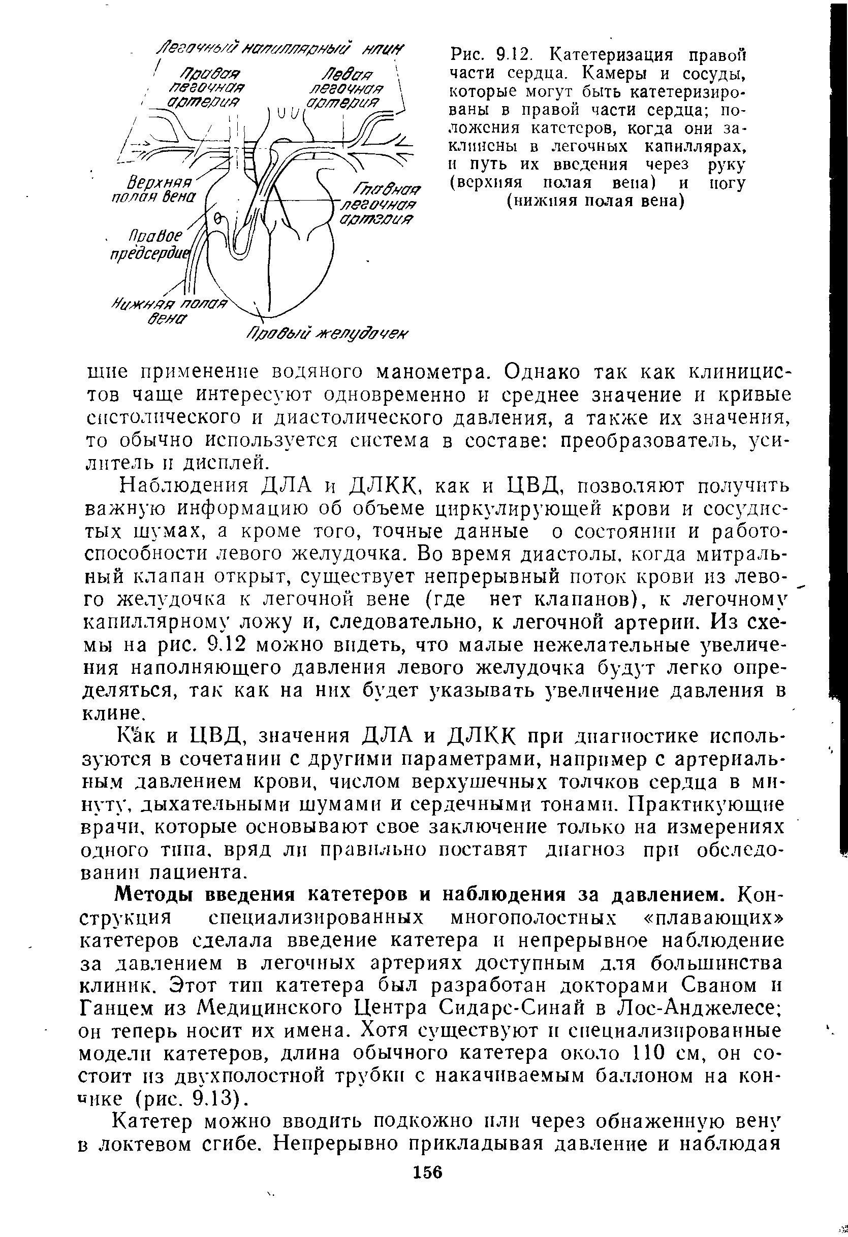 Рис. 9.12. Катетеризация правой части сердца. Камеры и сосуды, которые могут быть катетеризированы в правой части сердца положения катетеров, когда они заклинены в легочных капиллярах, и путь их введения через руку (верхняя полая вена) и йогу (нижняя полая вена)...