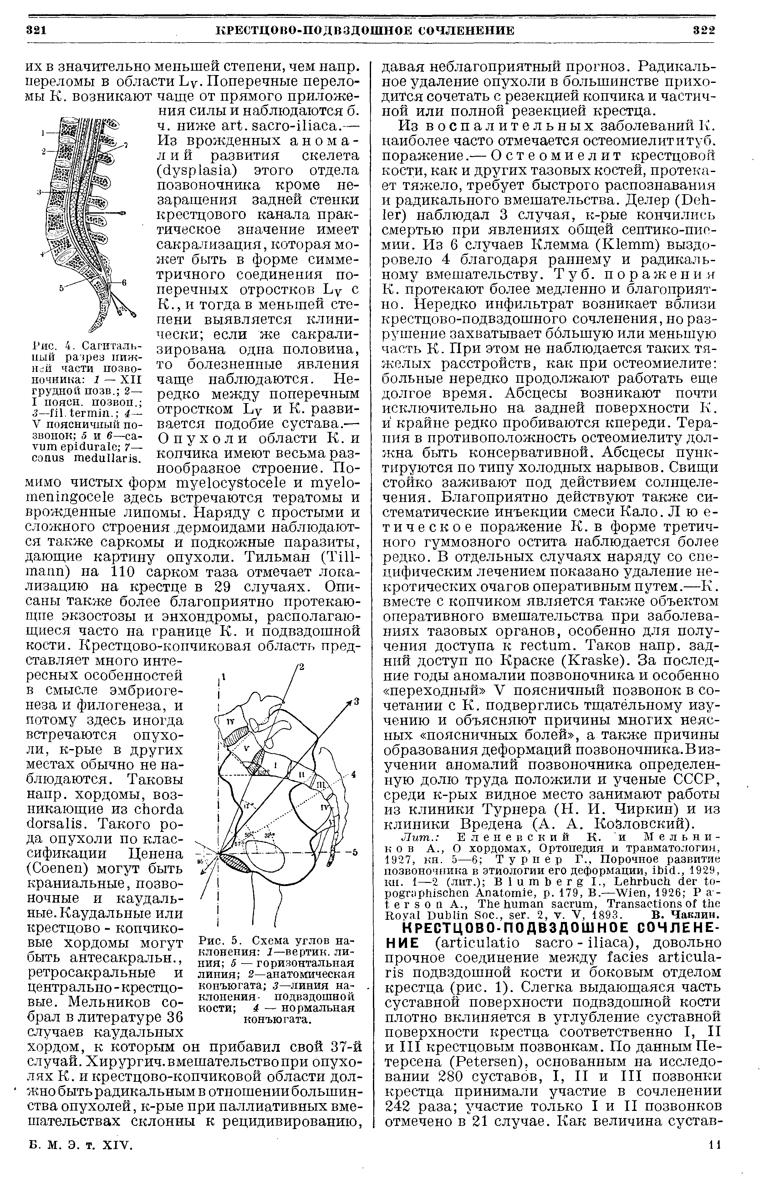 Рис. 5. Схема углов наклонения 1—вертик. линия 5 — горизонтальная линия 2—анатомическая конъюгата 3—линия наклонения- подвздошной кости 4 — нормальная конъюгата.