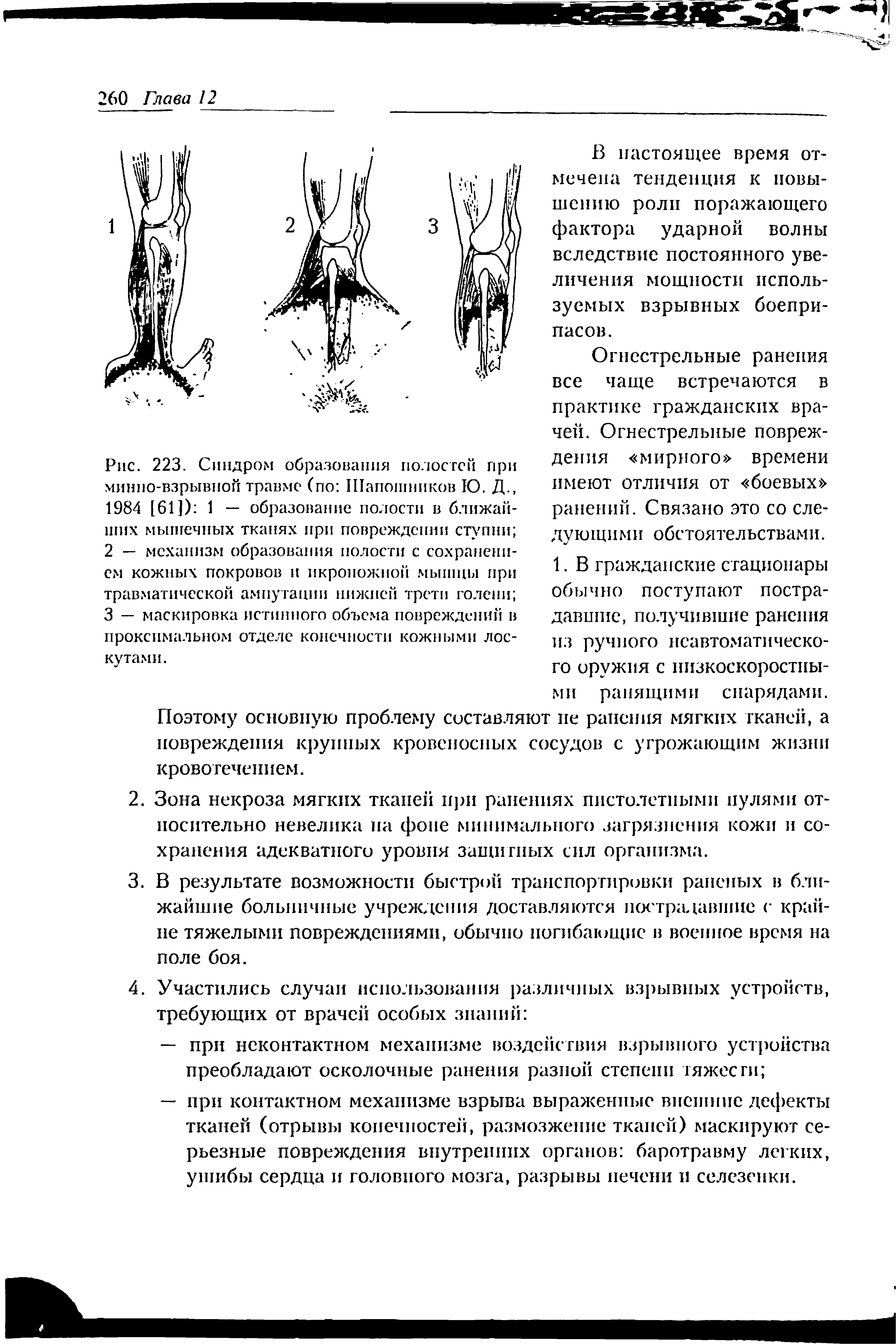 Рис. 223. Синдром образования полостей при минно-взрывной травме (по Шапошников Ю. Д., 1984 [61]) 1 — образование полости в ближайших мышечных тканях при повреждении ступни ...