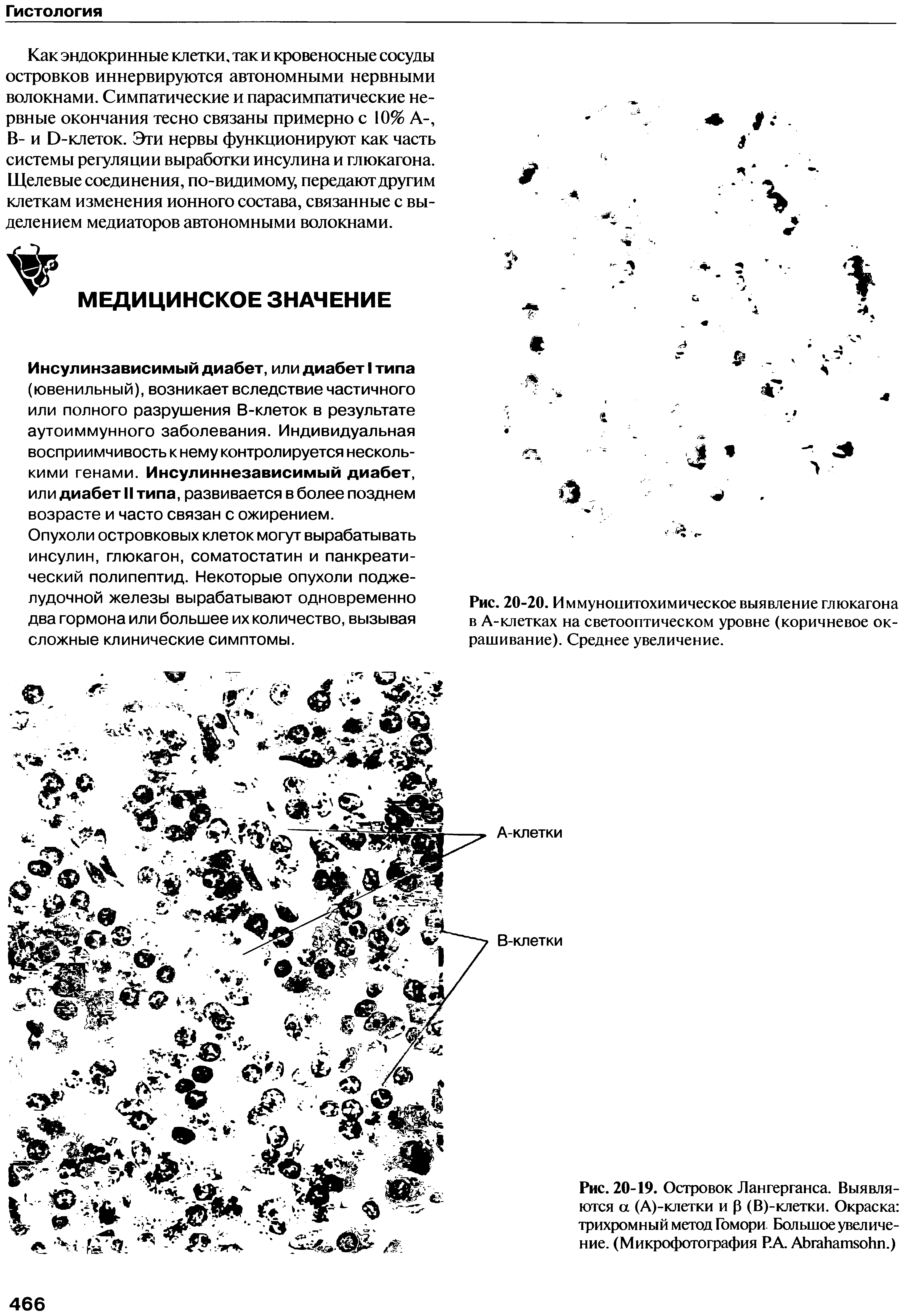 Рис. 20-19. Островок Лангерганса. Выявляются а (А)-клетки и р (В)-клетки. Окраска трихромный метод Гомори Большое увеличение. (Микрофотография Р.А АЬгаНапъоЬп.)...