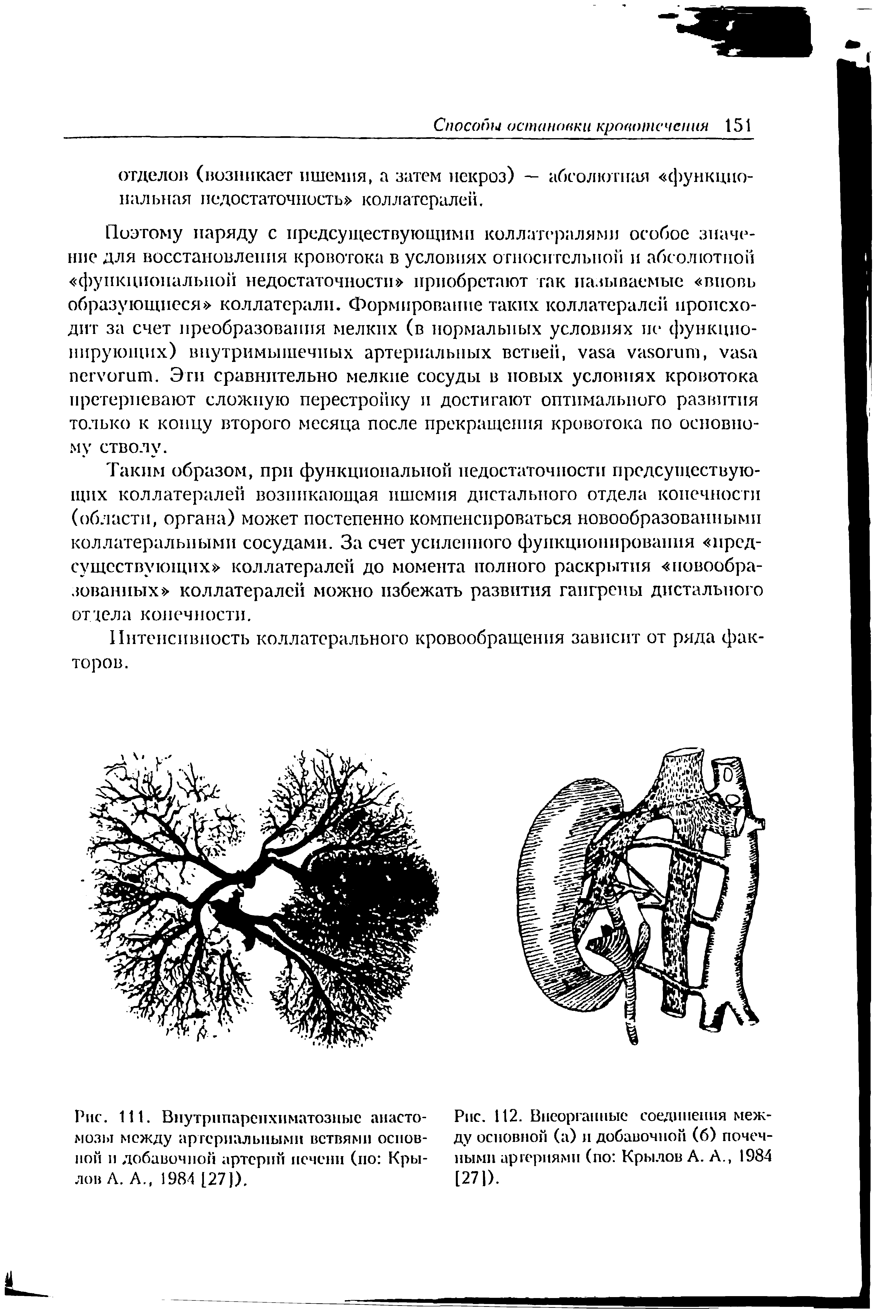 Рис. 111. Внутрипаренхиматозные анастомозы между артериальными ветвями основной и добавочной артерий печени (по Крылов Л. А., 1984 [27]).