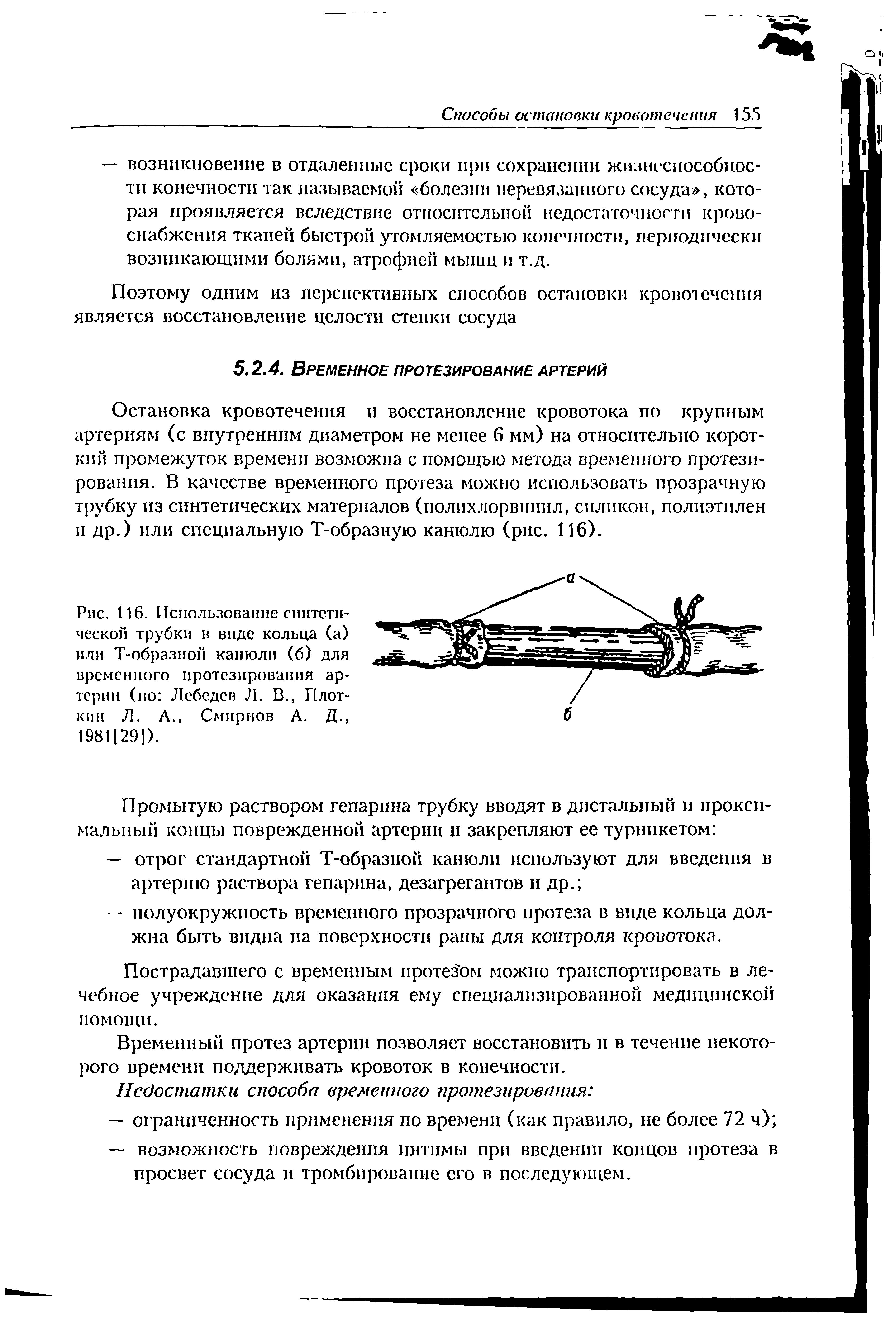 Рис. 116. Использование синтетической трубки в виде кольца (а) или Т-образной канюли (б) для временного протезирования артерии (по Лебедев Л. В., Плоткин Л. А., Смирнов А. Д., 1981129]).