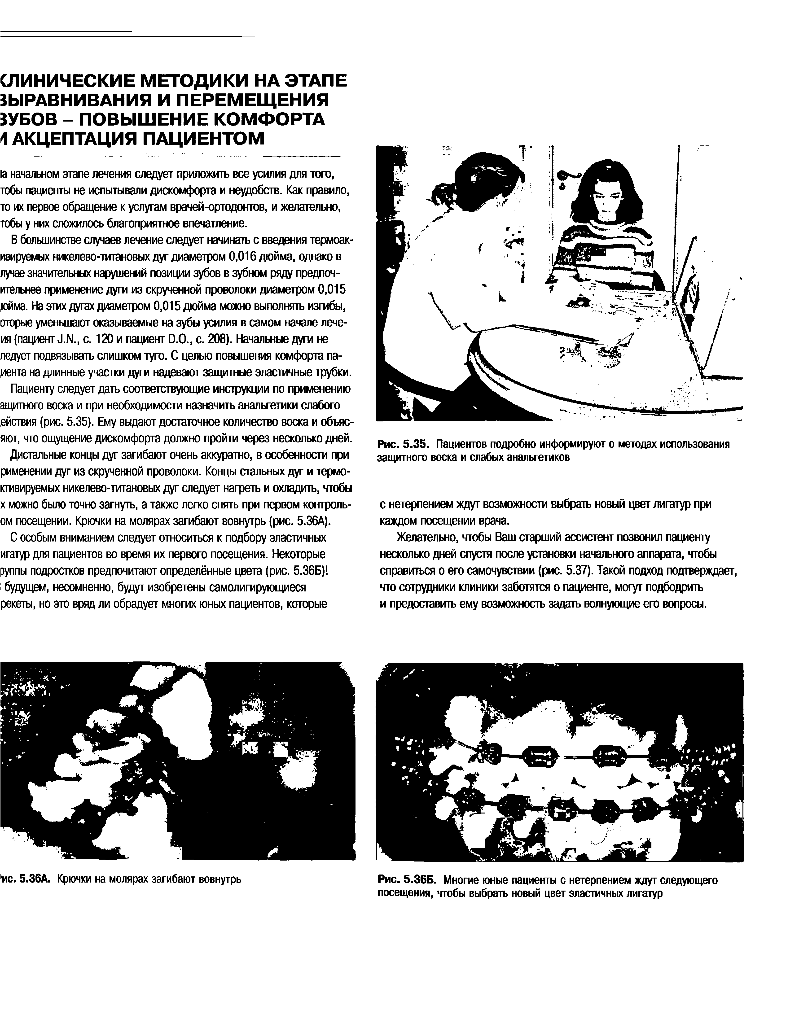 Рис. 5.36Б. Многие юные пациенты с нетерпением ждут следующего посещения, чтобы выбрать новый цвет эластичных лигатур...