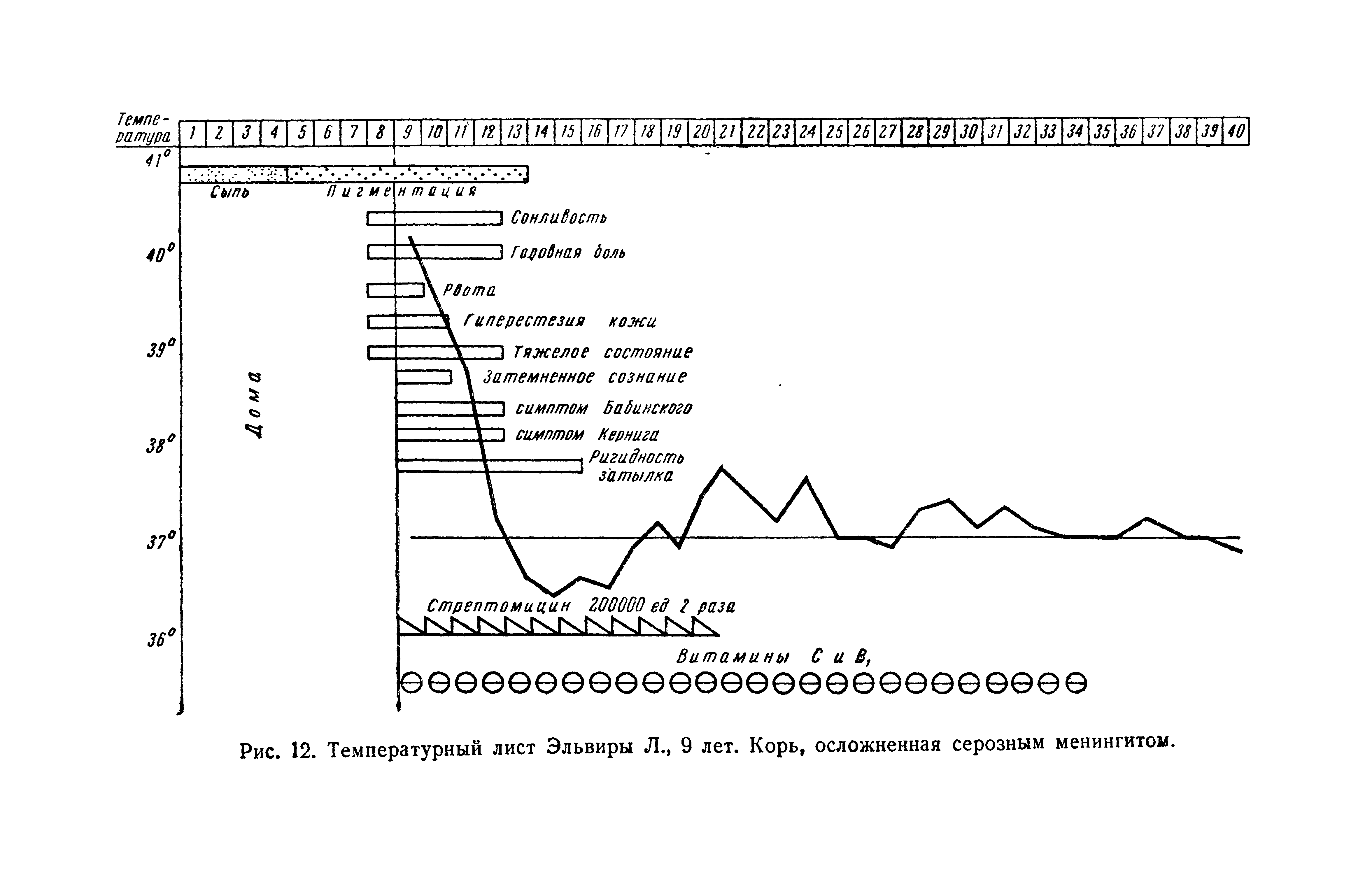 Рис. 12. Температурный лист Эльвиры Л., 9 лет. Корь, осложненная серозным менингитом.