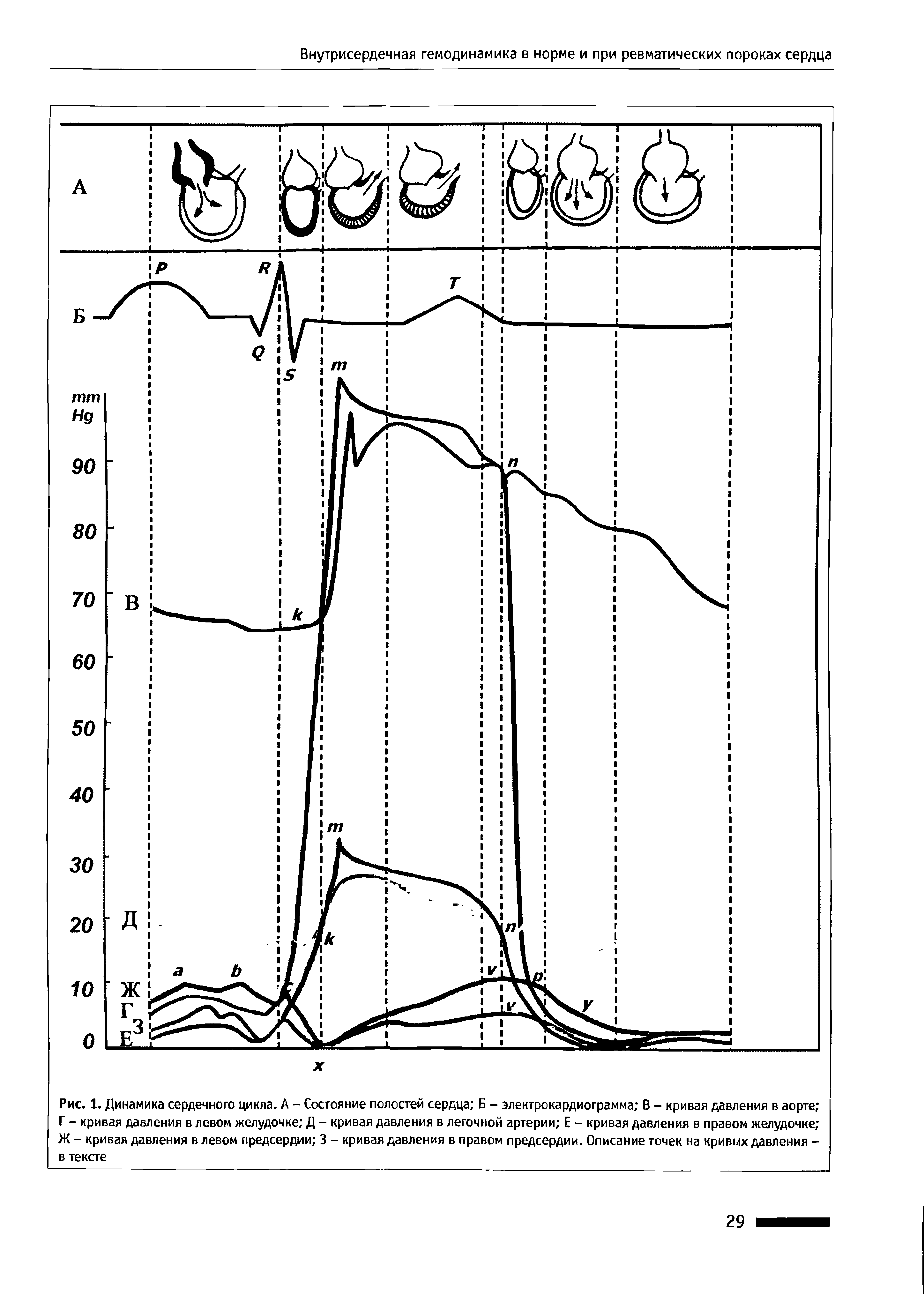 Рис. 1. Динамика сердечного цикла. А - Состояние полостей сердца Б - электрокардиограмма В - кривая давления в аорте Г - кривая давления в левом желудочке Д - кривая давления в легочной артерии Е - кривая давления в правом желудочке Ж - кривая давления в левом предсердии 3 - кривая давления в правом предсердии. Описание точек на кривых давления -в тексте...