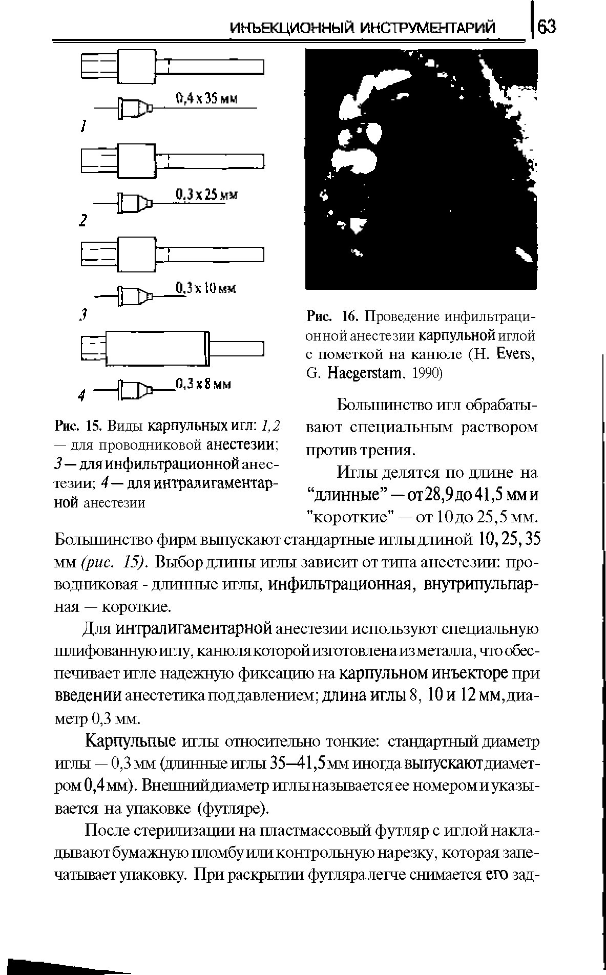 Рис. 16. Проведение инфильтрационной анестезии карпульной иглой с пометкой на канюле (Н. E , G. H , 1990)...