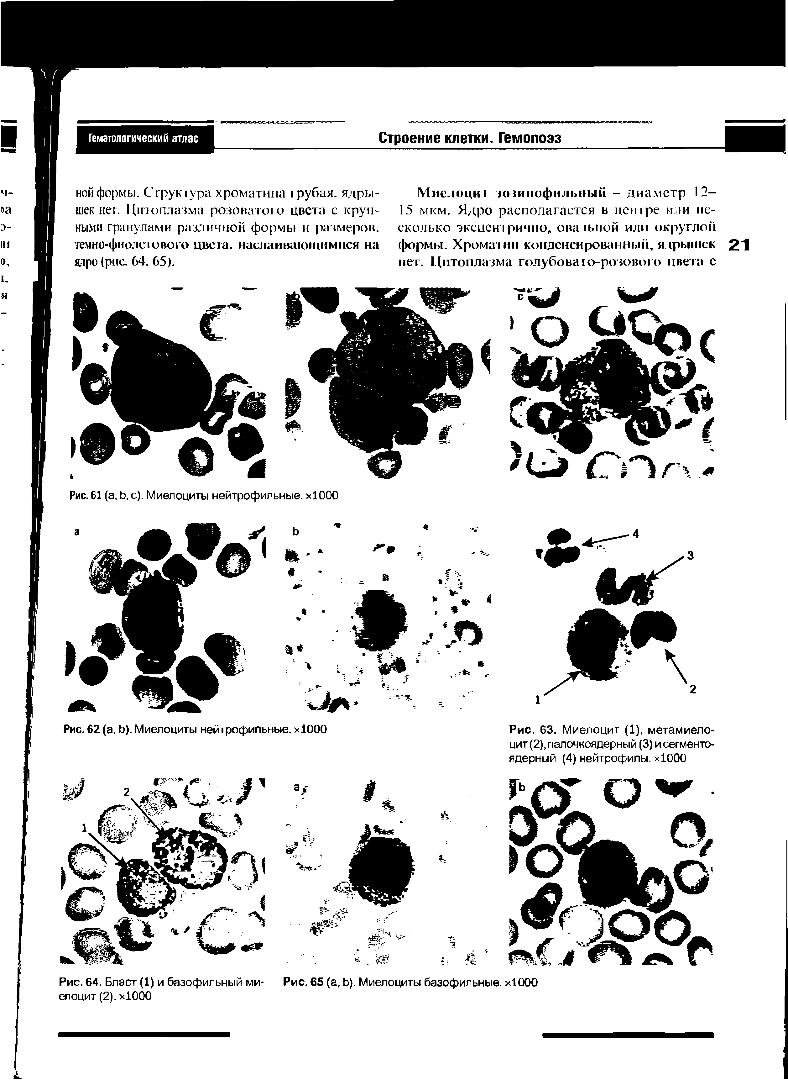 Рис. 63. Миелоцит (1), метамиелоцит (2), палочкоядерный (3) и сегментоядерный (4) нейтрофилы. хЮОО...