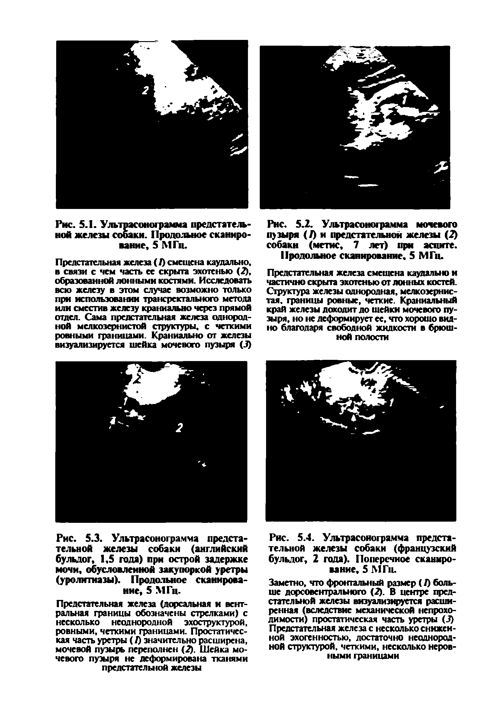 Рис. 5.3. Ультрасонограмма предстательной железы собаки (английский бульдог, 1,5 года) при острой задержке мочи, обусловленной закупоркой уретры (уролитиазы). Продольное сканирование, 5 МГц.