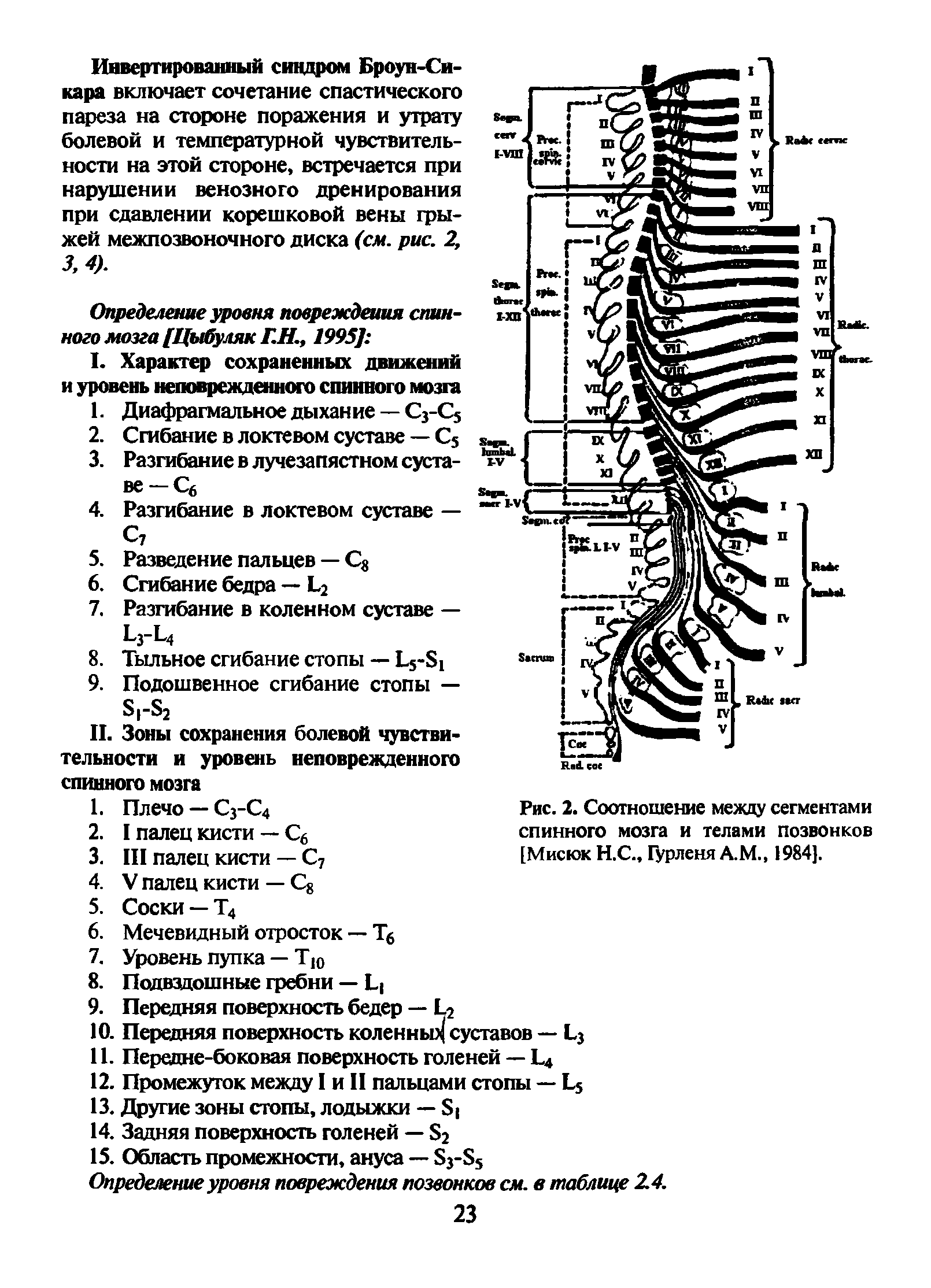Рис. 2. Соотношение между сегментами спинного мозга и телами позвонков [Мисюк Н.С., Гурленя А.М., 1984].