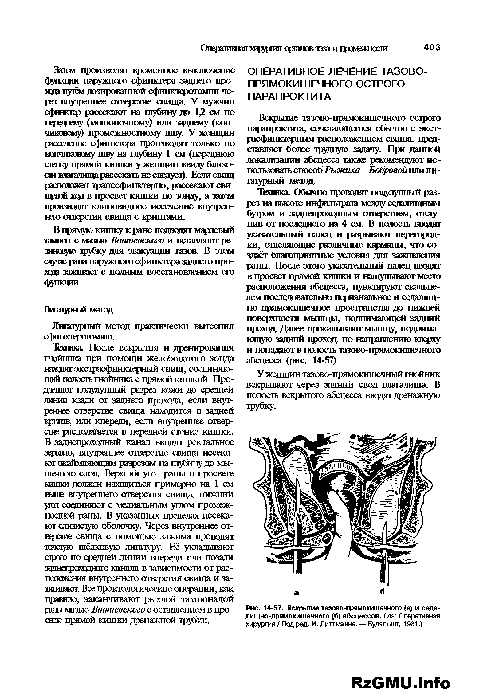 Рис. 14-57. Вскрытие тазово-прямокишечного (а) и седалищно-прямокишечного (б) абсцессов. (Из Оперативная хирургия / Под ред. И. Литтманна. —Будапешт, 1981.)...