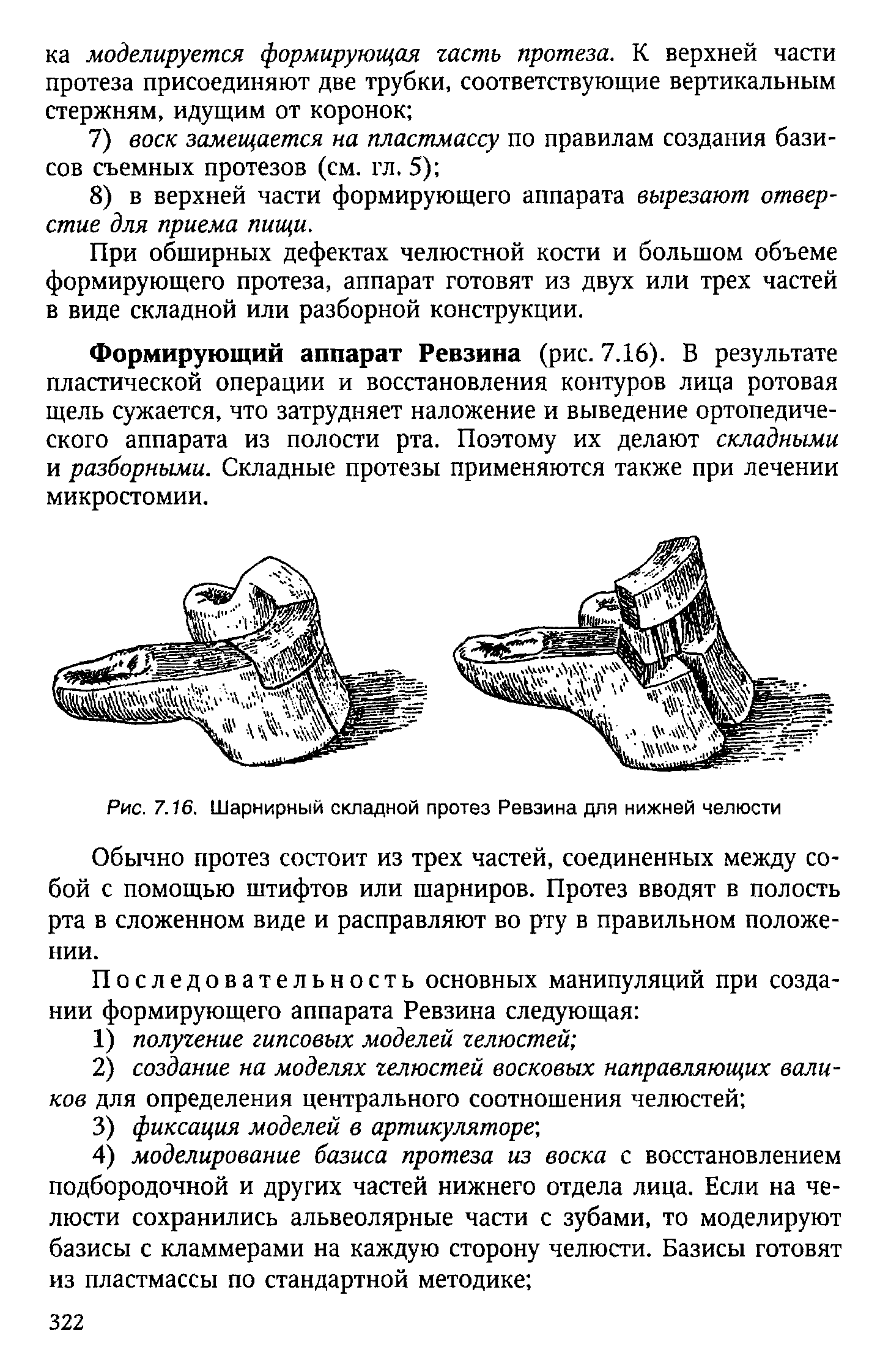 Рис. 7.16. Шарнирный складной протез Ревзина для нижней челюсти...