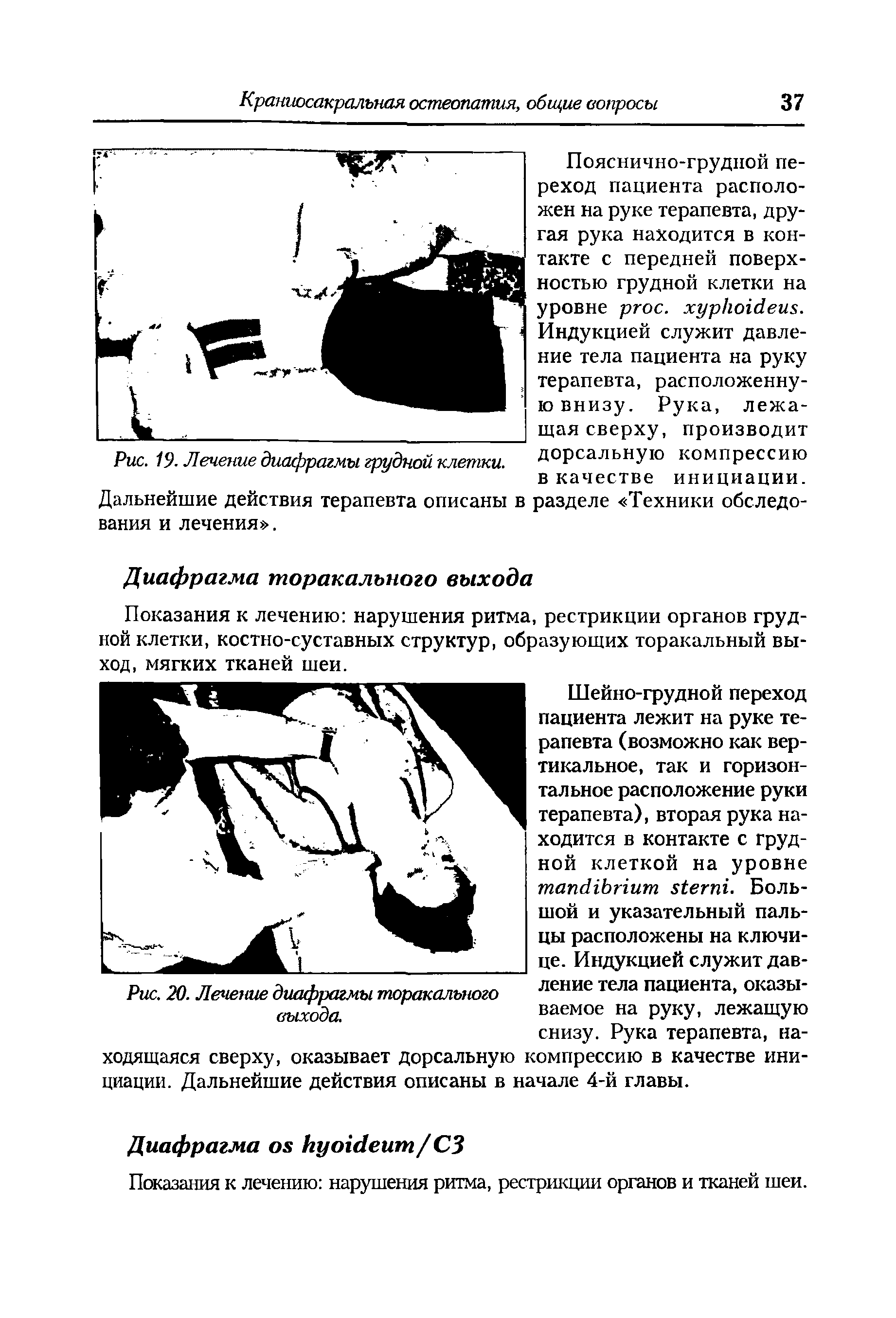 Рис. 19. Лечение диафрагмы грудной клетки. дорсальную компрессию...