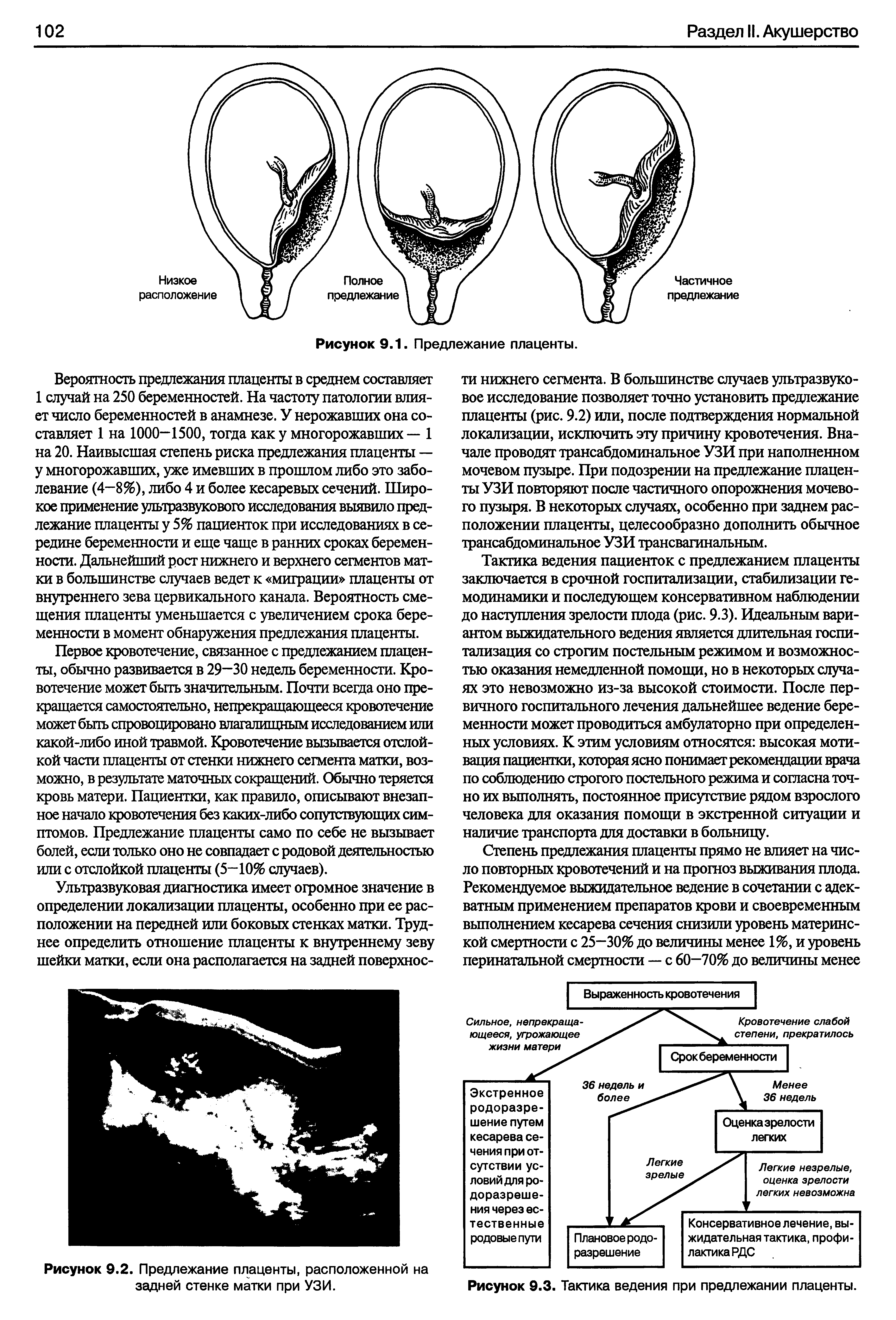 Рисунок 9.2. Предлежание плаценты, расположенной на задней стенке матки при УЗИ.