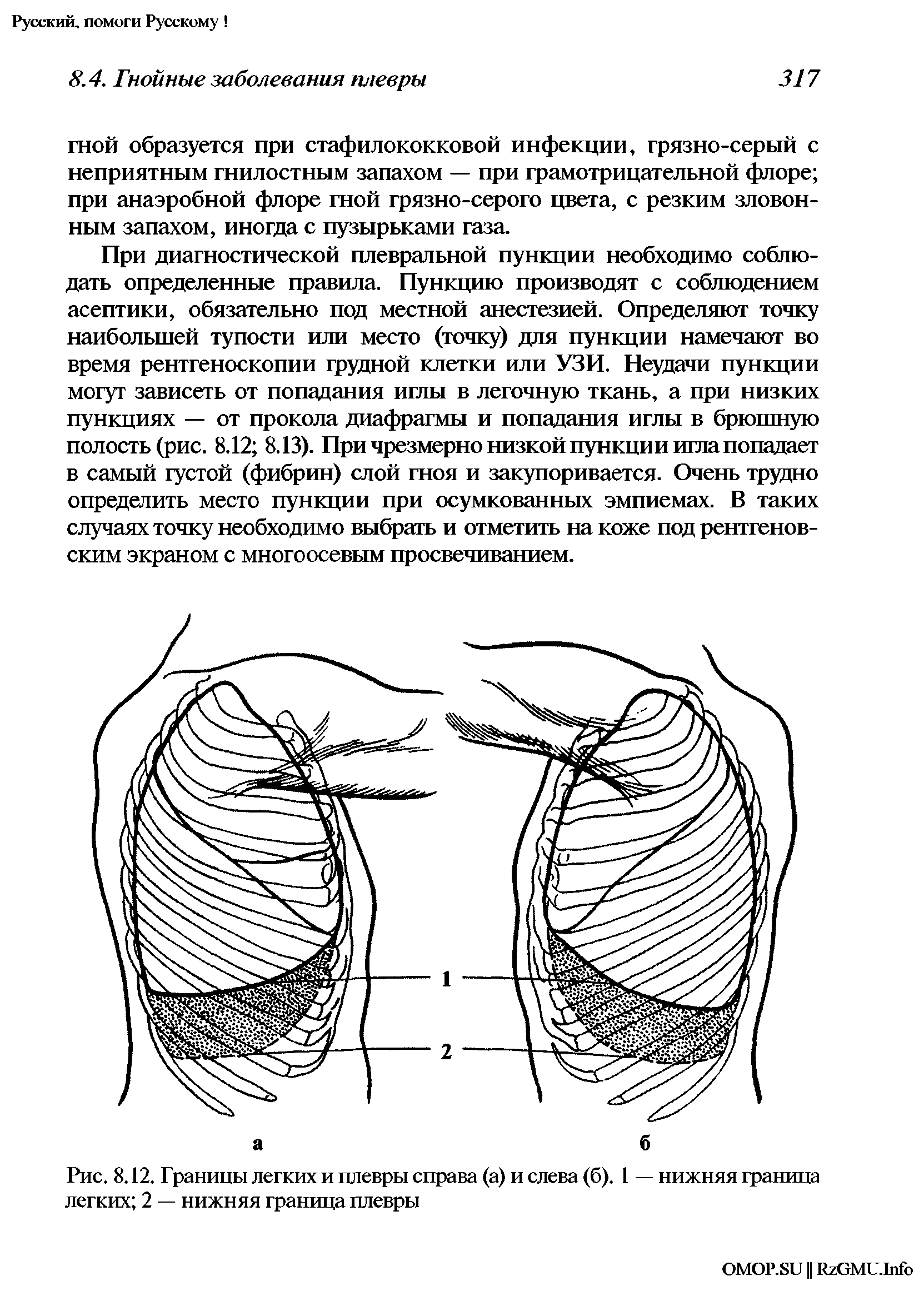 Рис. 8.12. Границы легких и плевры справа (а) и слева (б). 1 — нижняя граница легких 2 — нижняя граница плевры...