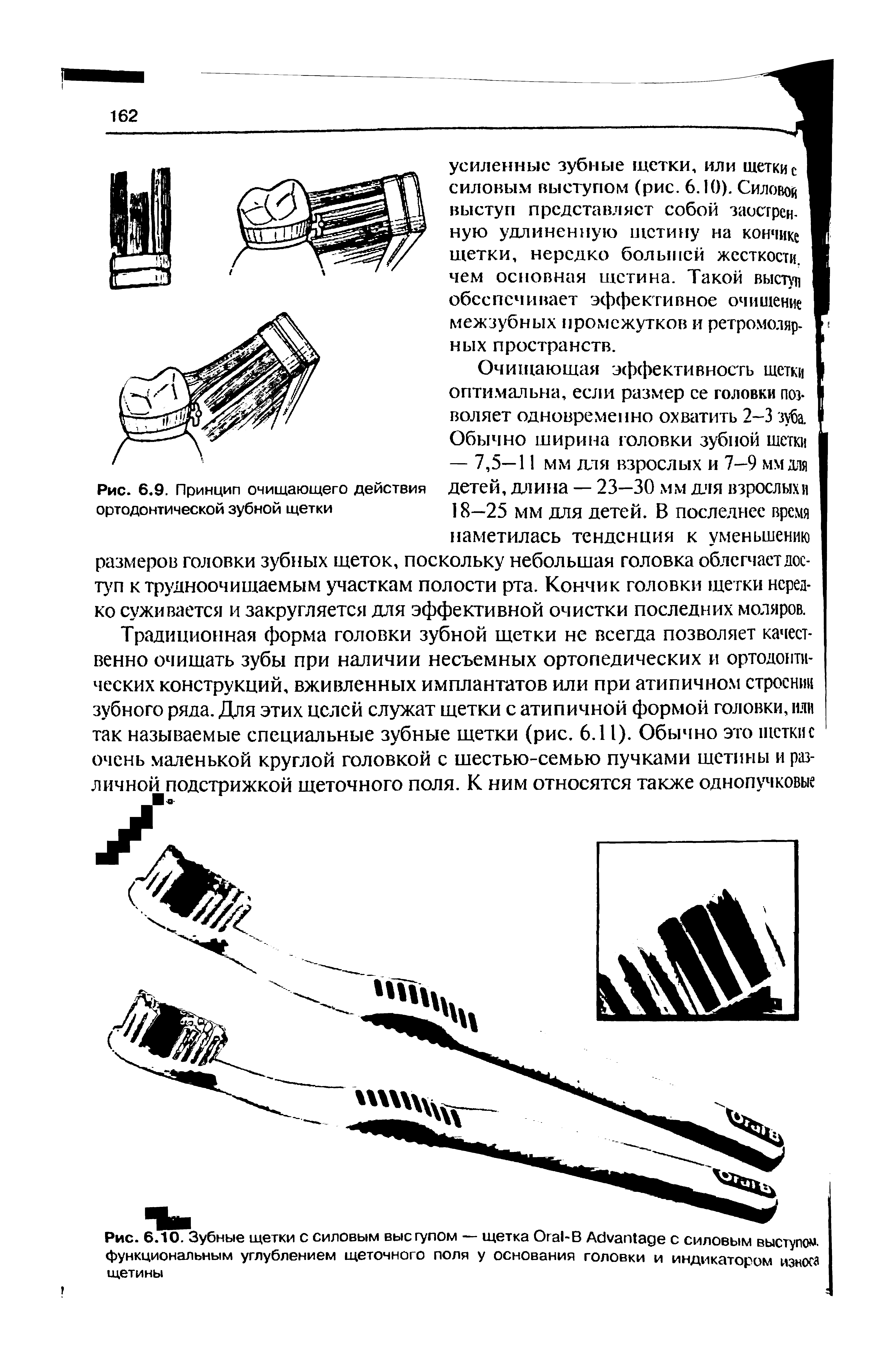 Рис. 6.10. Зубные щетки с силовым выс гулом — щетка O -В A с силовым выступом, функциональным углублением щеточного поля у основания головки и индикатором износа щетины...