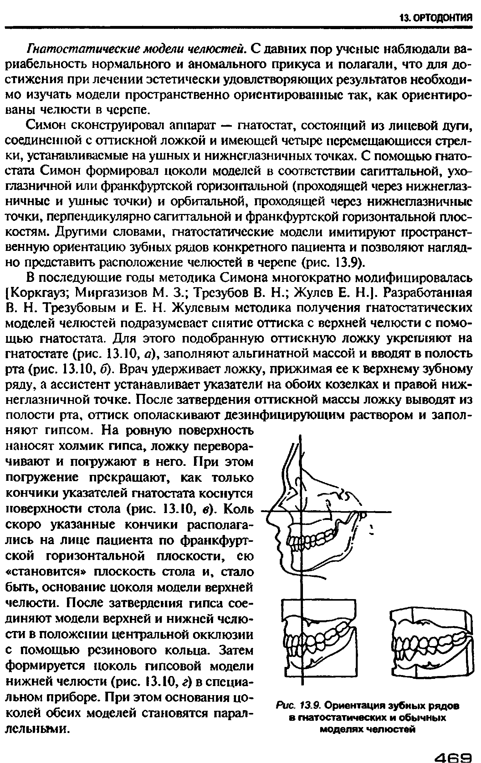 Рис. 13.9. Ориентация зубных рядов в гнатостатических и обычных моделях челюстей...