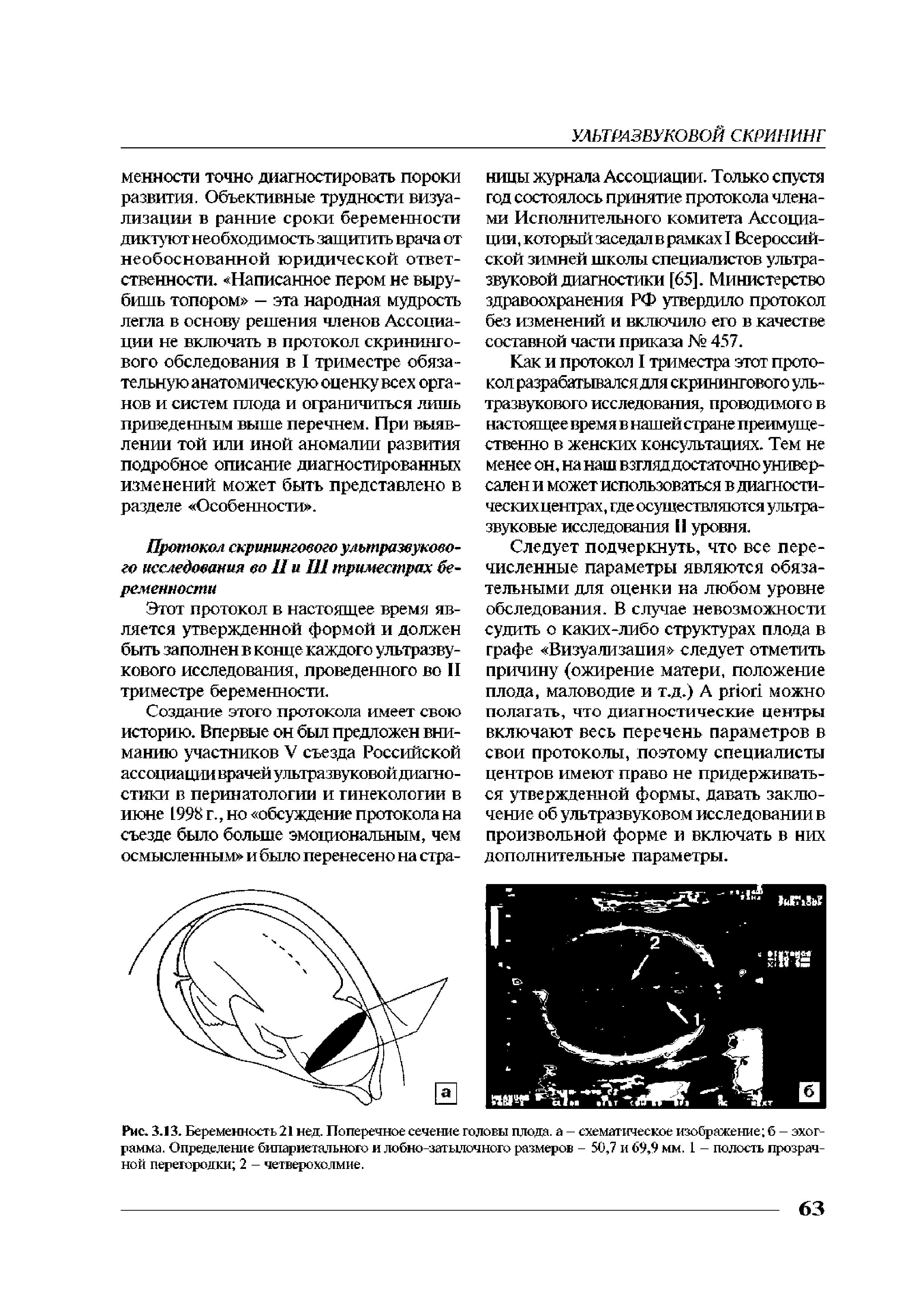 Рис. 3.13. Беременность 21 нед. Поперечное сечение головы плода, а - схематическое изображение б - эхограмма. Определение бипариетального и лобно-затылочного размеров - 50,7 и 69,9 мм. 1 - полость прозрачной перегородки 2 - четверохолмие.