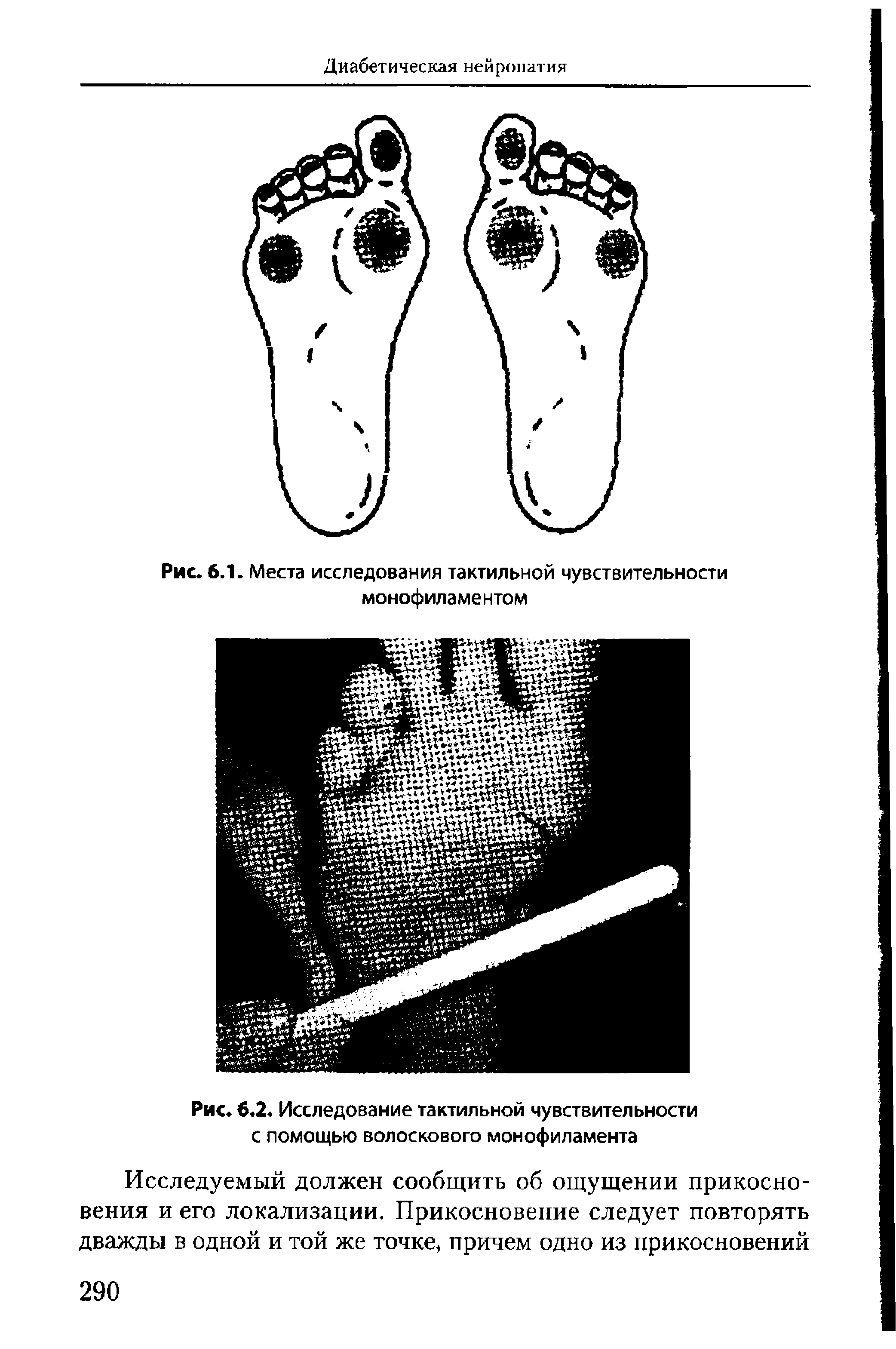 Рис. 6.2. Исследование тактильной чувствительности с помощью волоскового монофиламента...