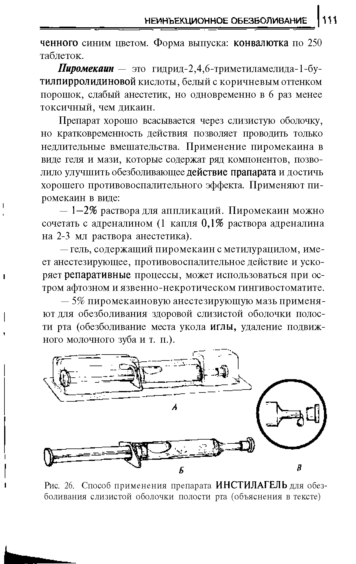 Рис. 26. Способ применения препарата ИНСТИЛАГЕЛЬ для обезболивания слизистой оболочки полости рта (объяснения в тексте)...