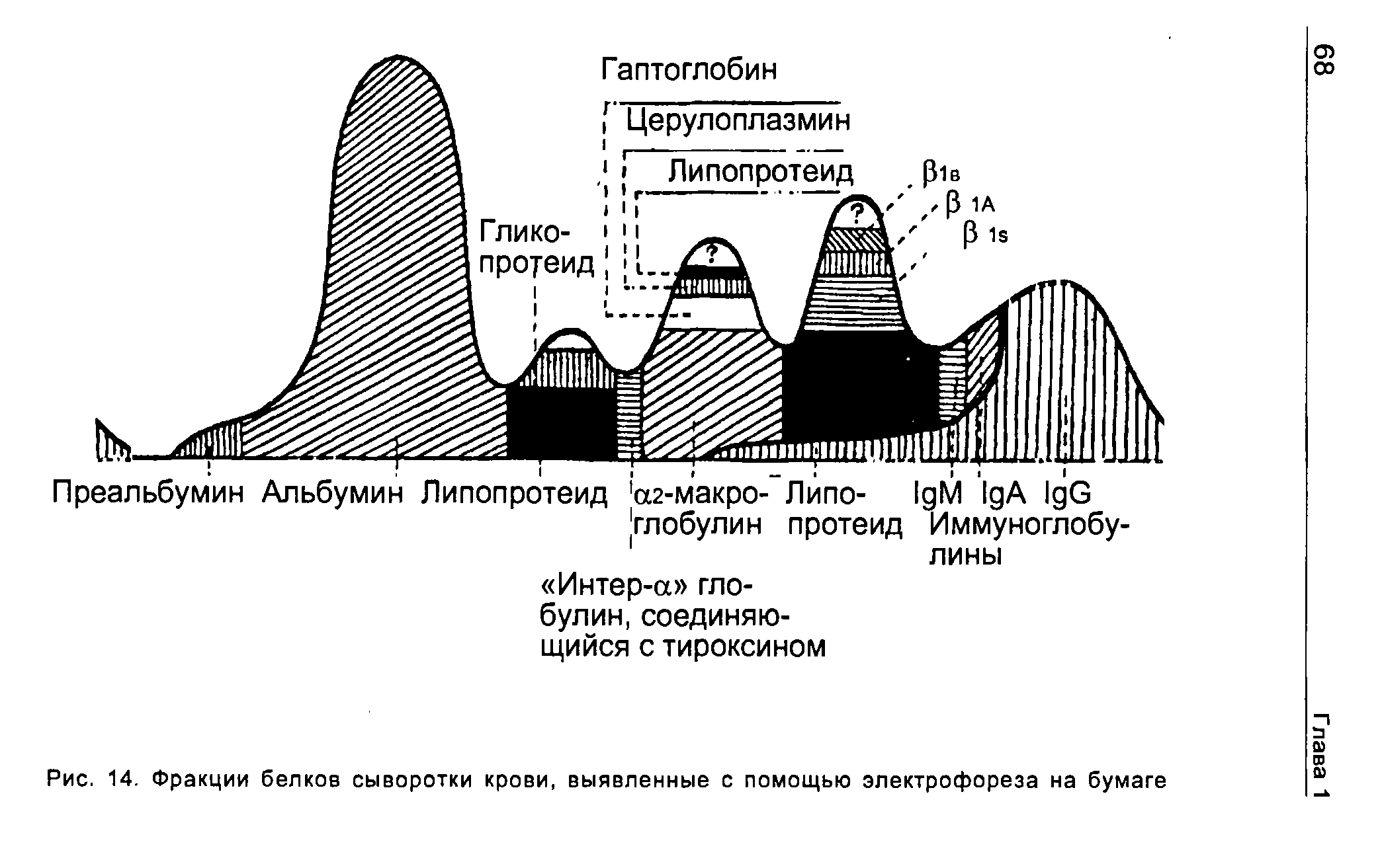 Рис. 14. Фракции белков сыворотки крови, выявленные с помощью электрофореза на бумаге...