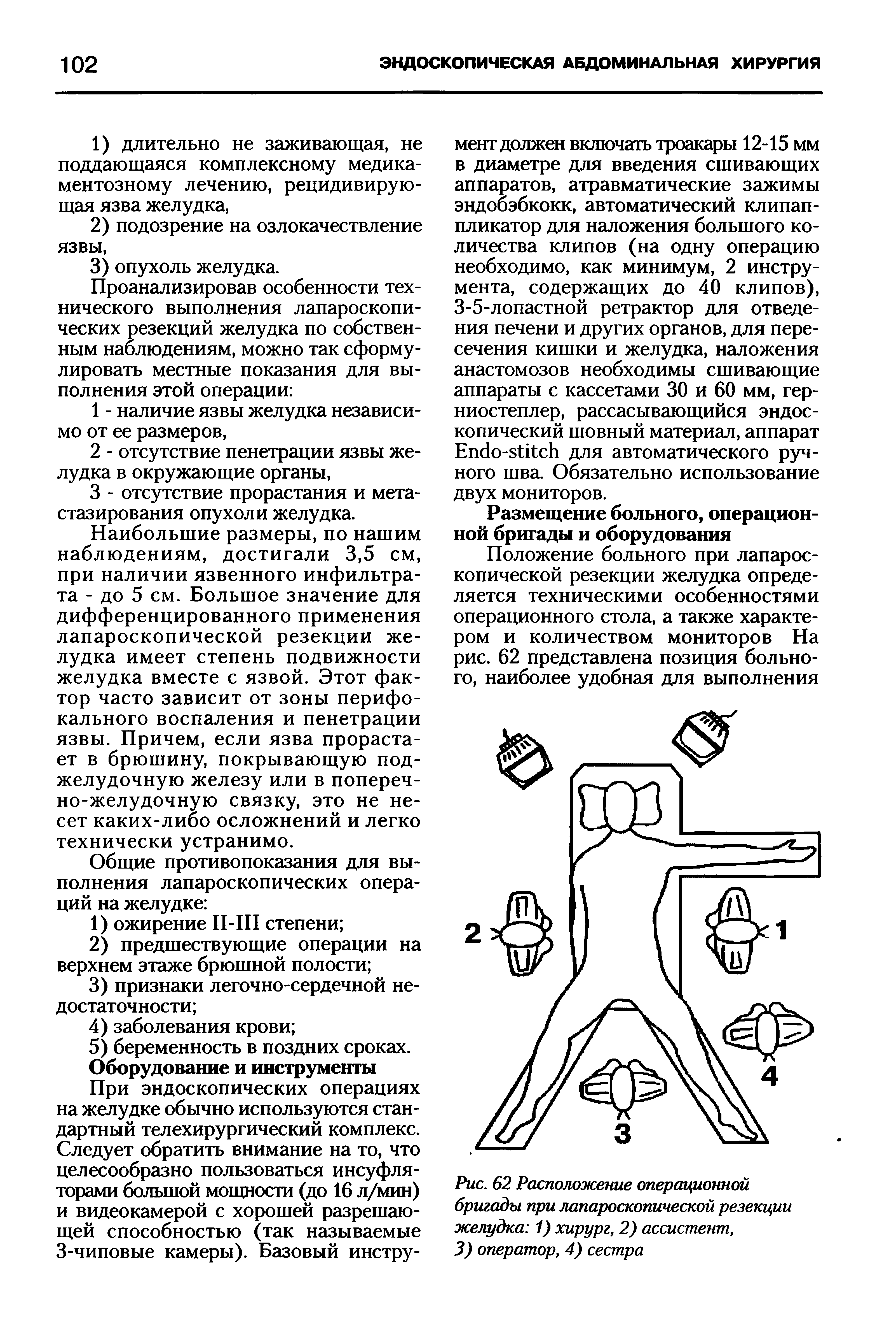 Рис. 62 Расположение операционной бригады при лапароскопической резекции желудка 1) хирург, 2) ассистент, 3) оператор, 4) сестра...