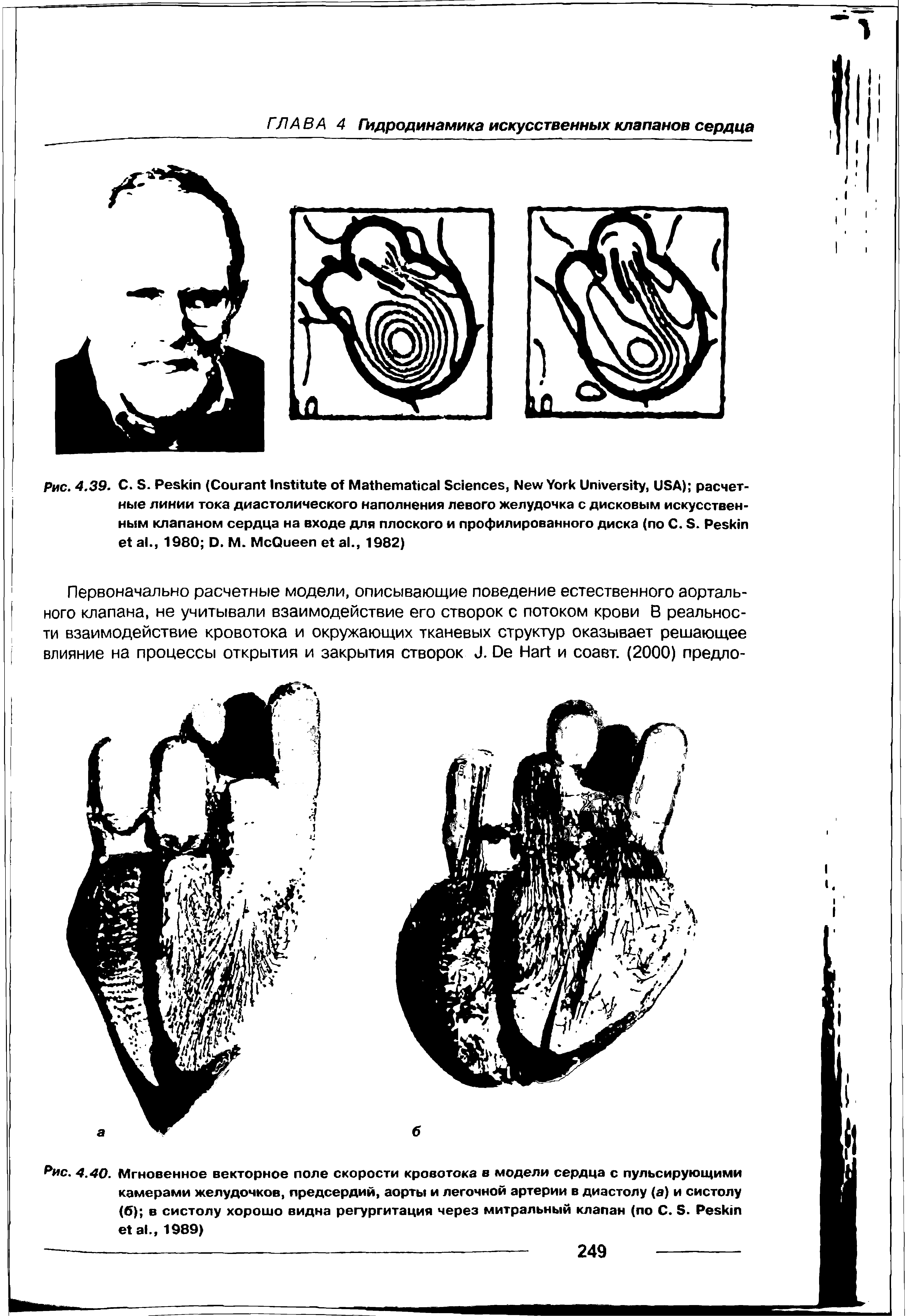 Рис. 4.40. Мгновенное векторное поле скорости кровотока в модели сердца с пульсирующими камерами желудочков, предсердий, аорты и легочной артерии в диастолу (а) и систолу (б) в систолу хорошо видна регургитация через митральный клапан (по С. Б. Ре б кт е1 ак, 1989)...